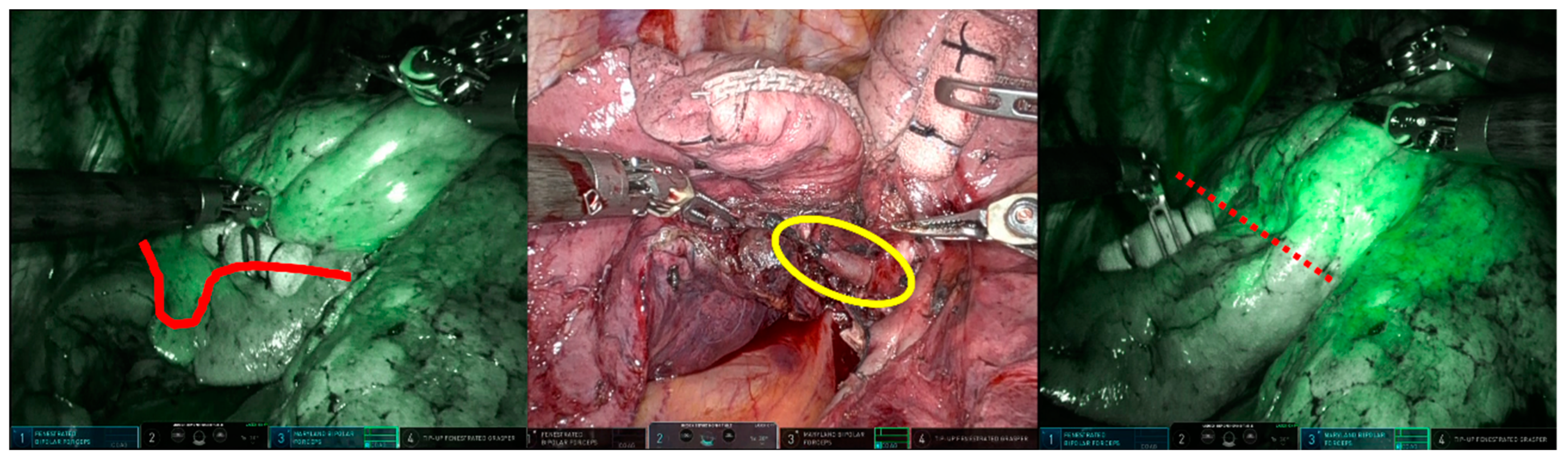 Cancers 15 05876 g005 Cancers 15 05876 g005