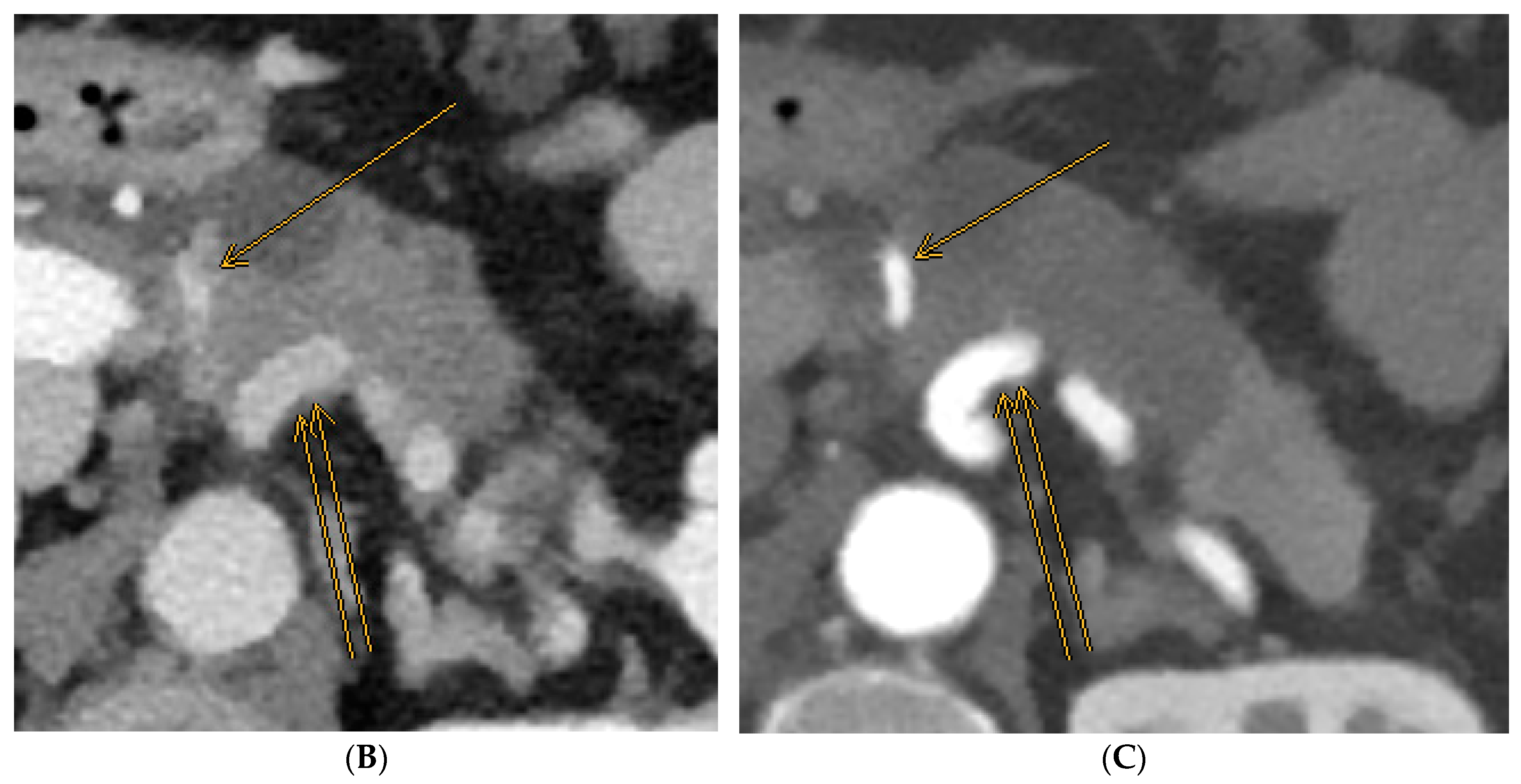 Cancers 15 05881 g001b