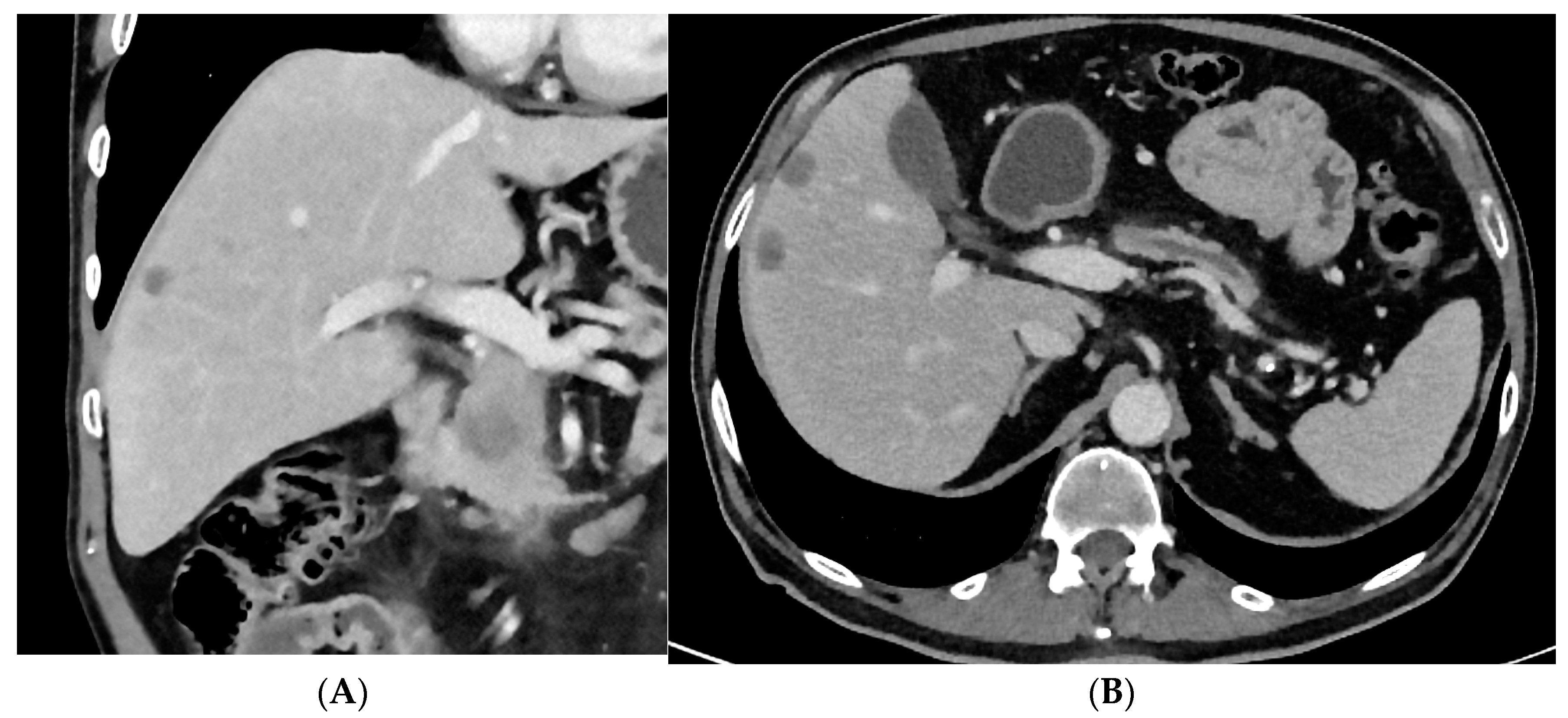 Cancers 15 05881 g002