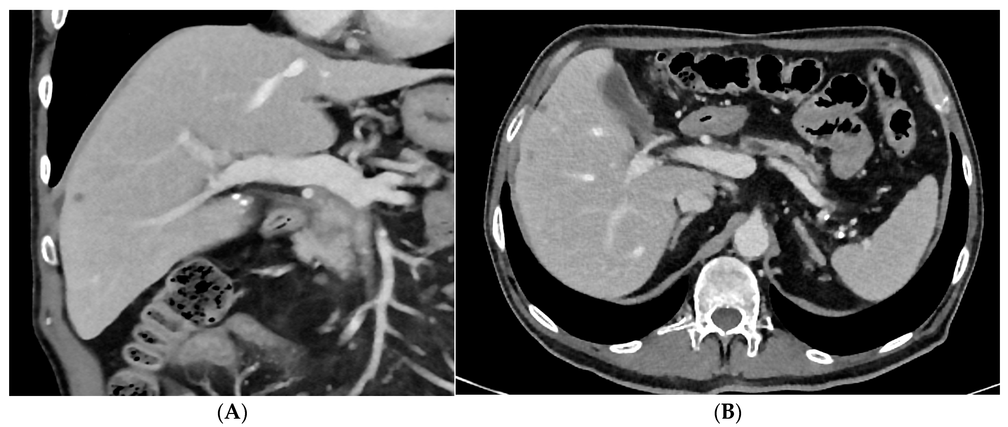 Cancers 15 05881 g003