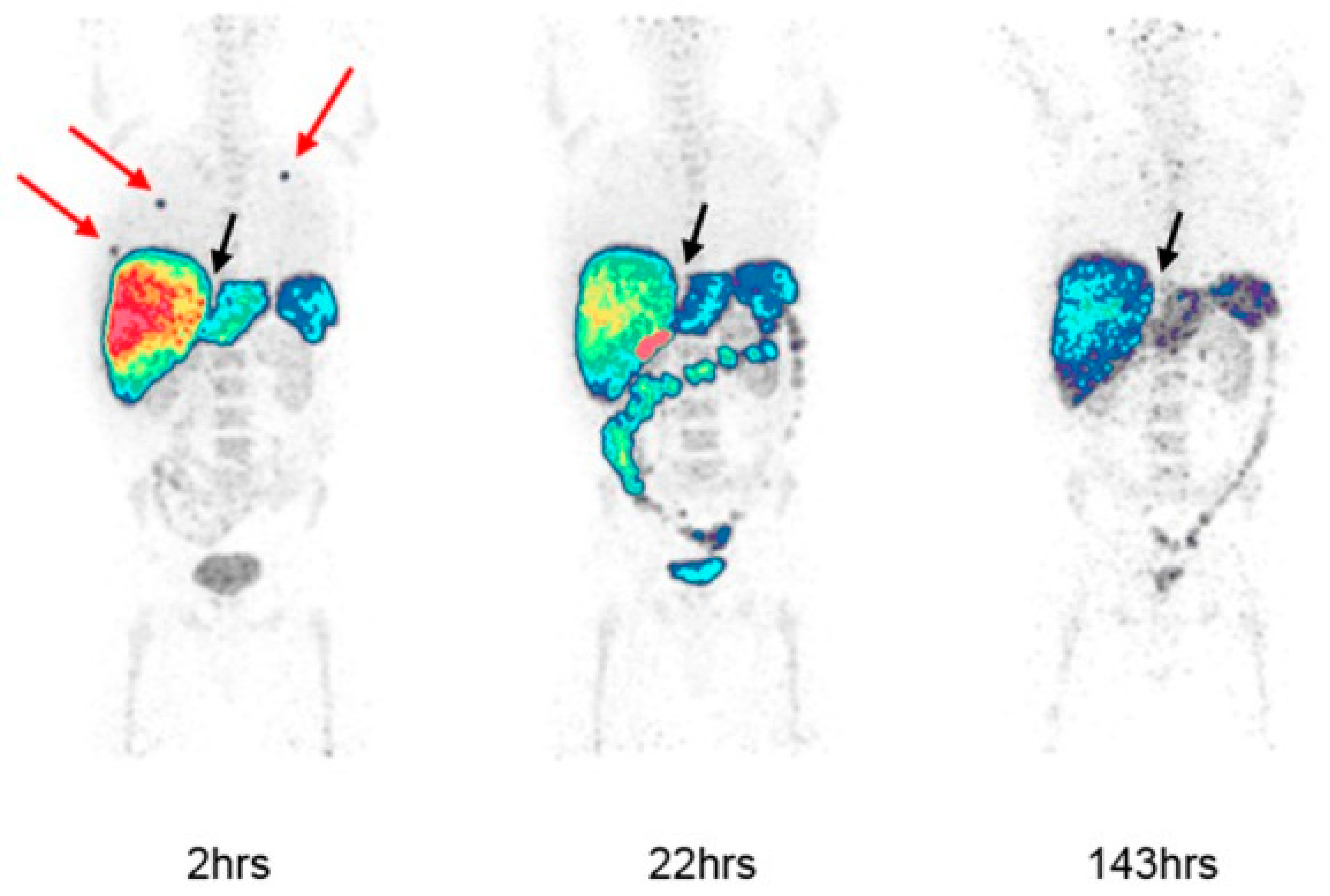 Cancers 15 05886 g002 Cancers 15 05886 g002
