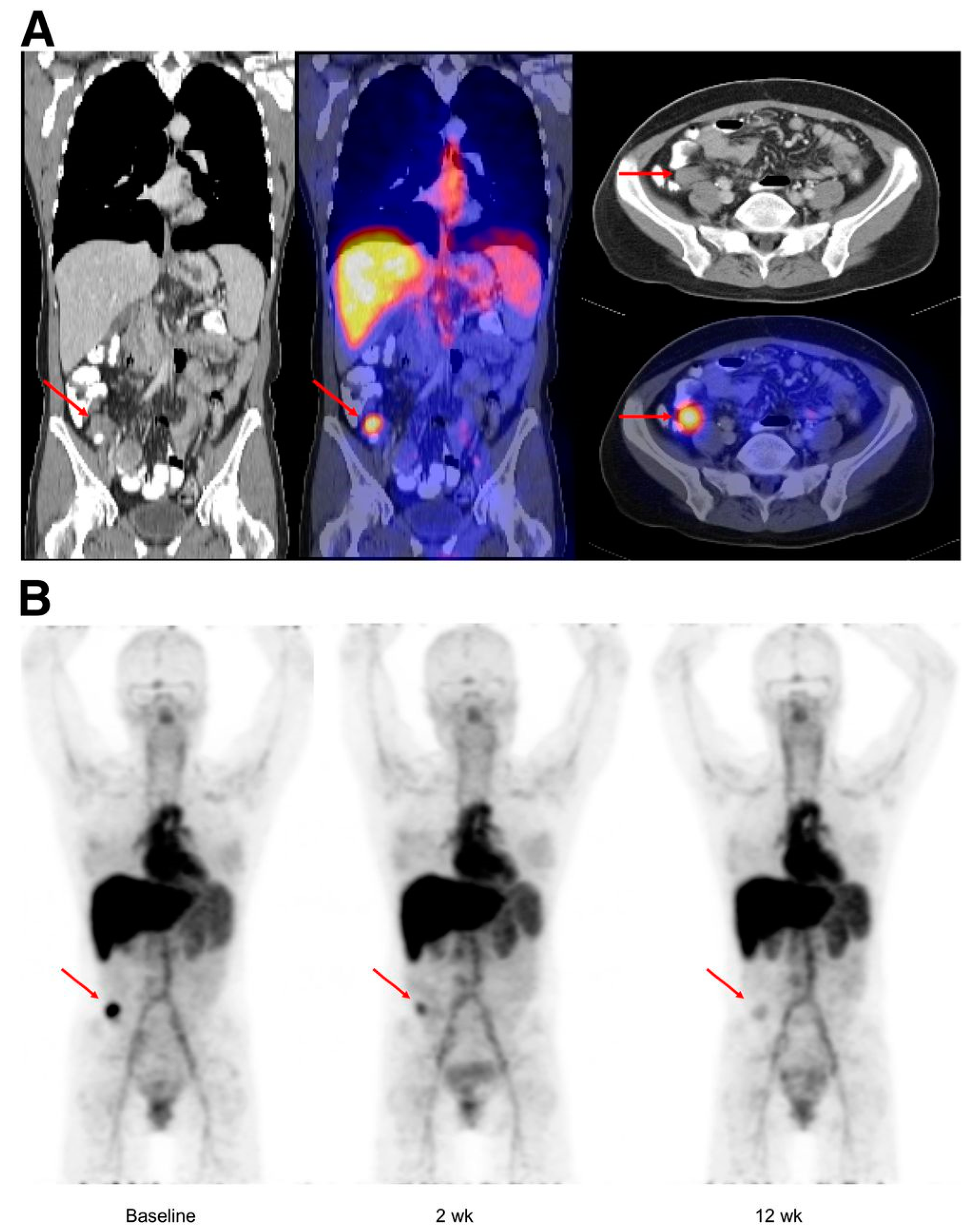 Cancers 15 05886 g004 Cancers 15 05886 g004