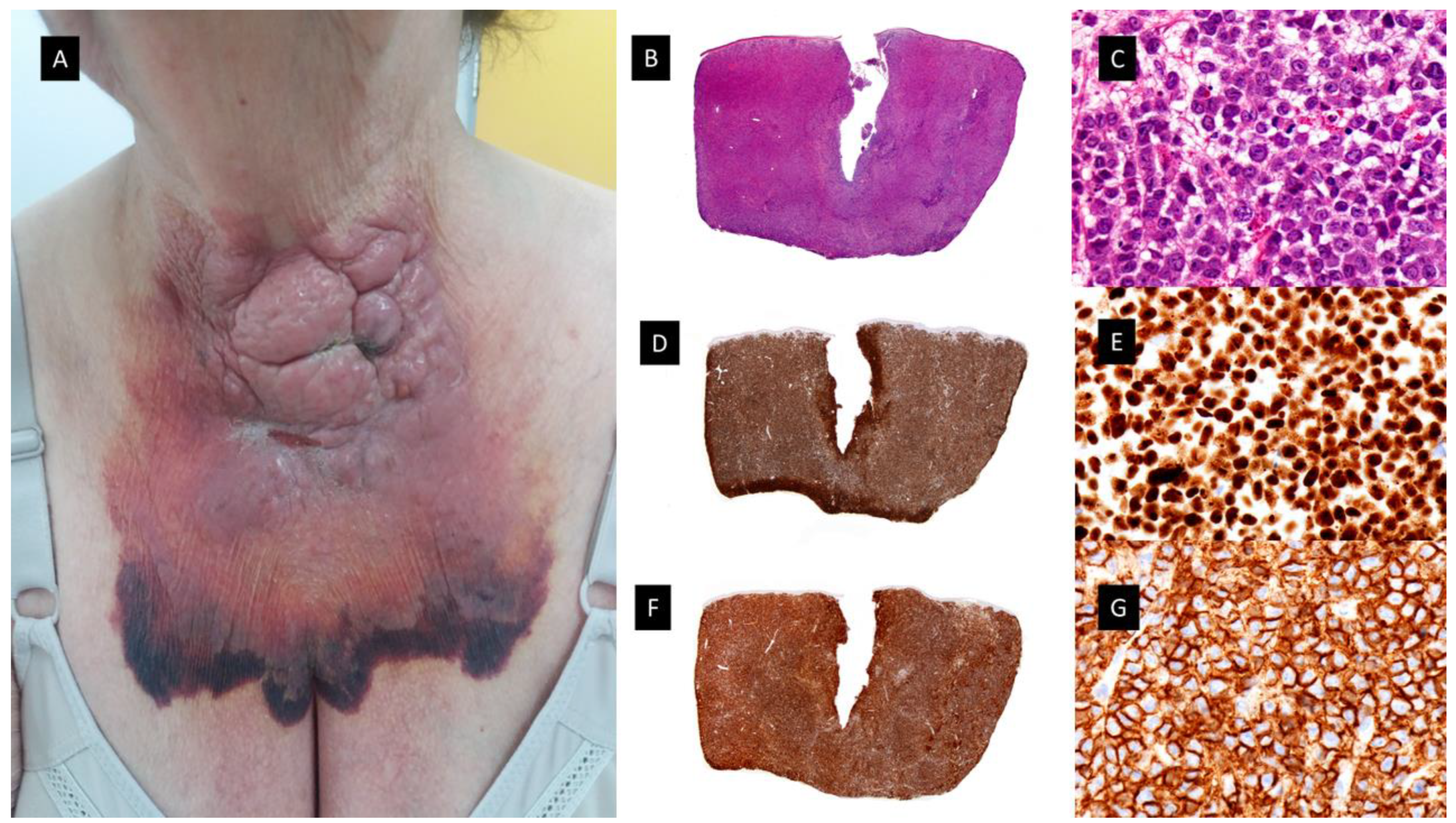 Cancers 15 05888 g004