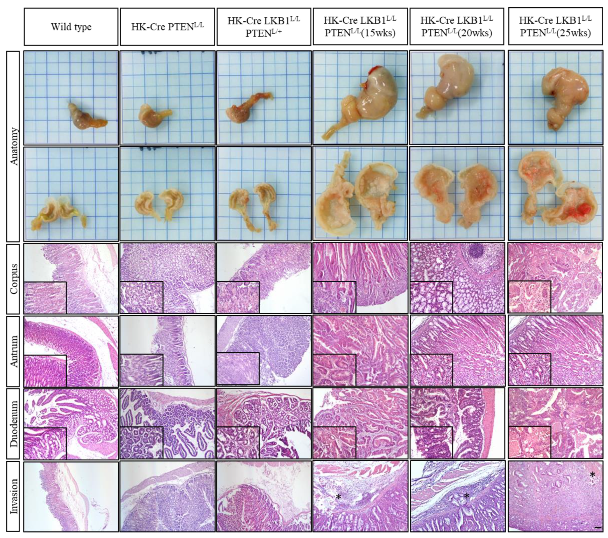 Cancers 15 05893 g003 Cancers 15 05893 g003