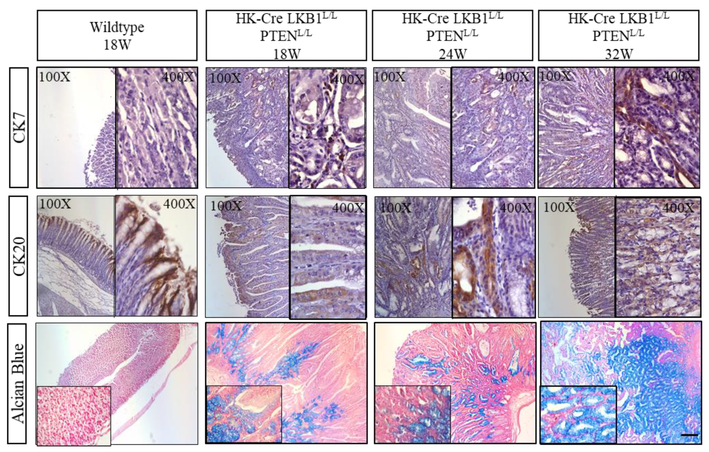 Cancers 15 05893 g005 Cancers 15 05893 g005