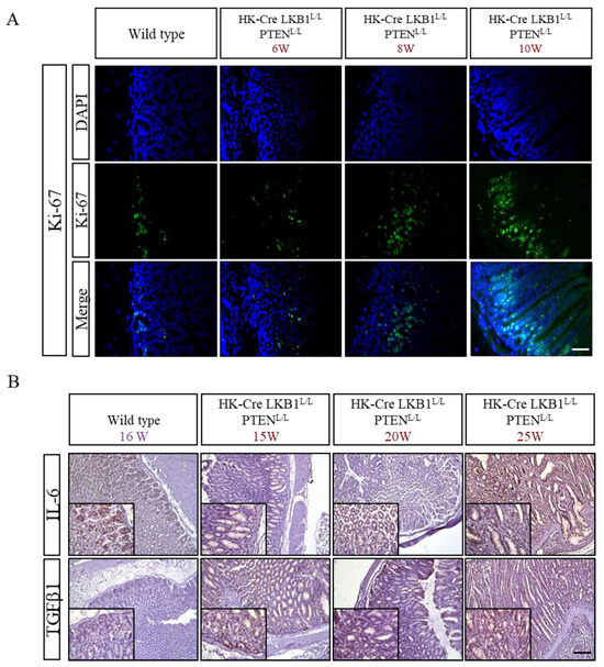 Development of a Genetically Engineered Mouse Model Recapitulating LKB1 ...