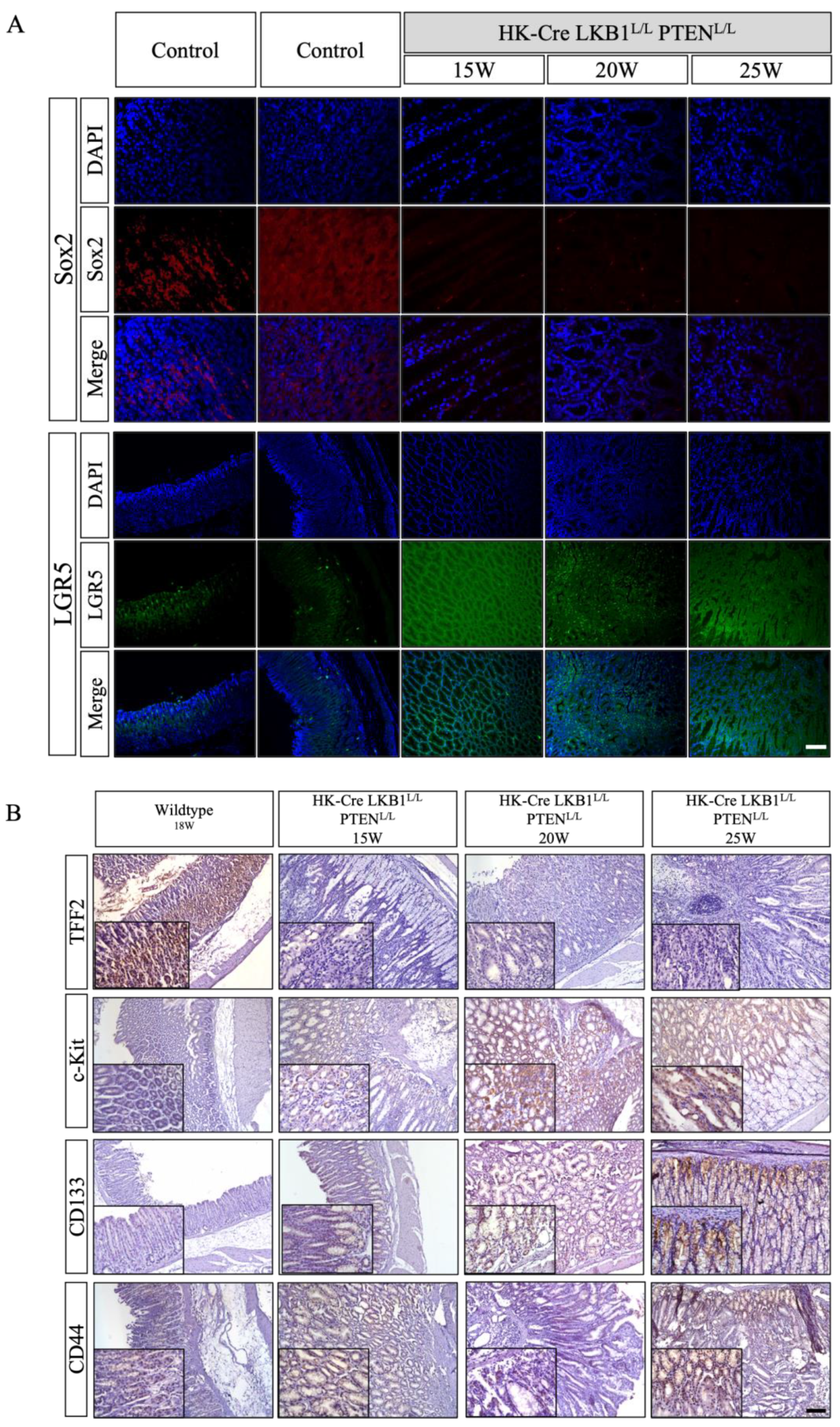 Cancers 15 05893 g008 Cancers 15 05893 g008