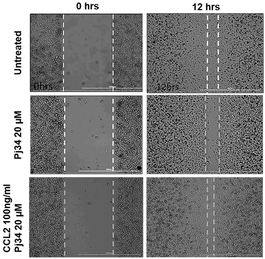 Cancers 16 00007 i001
