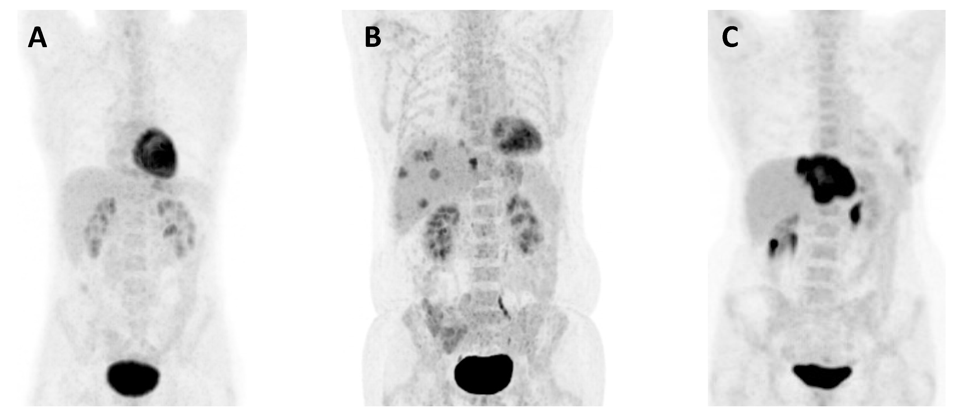 Cancers 16 00019 g004