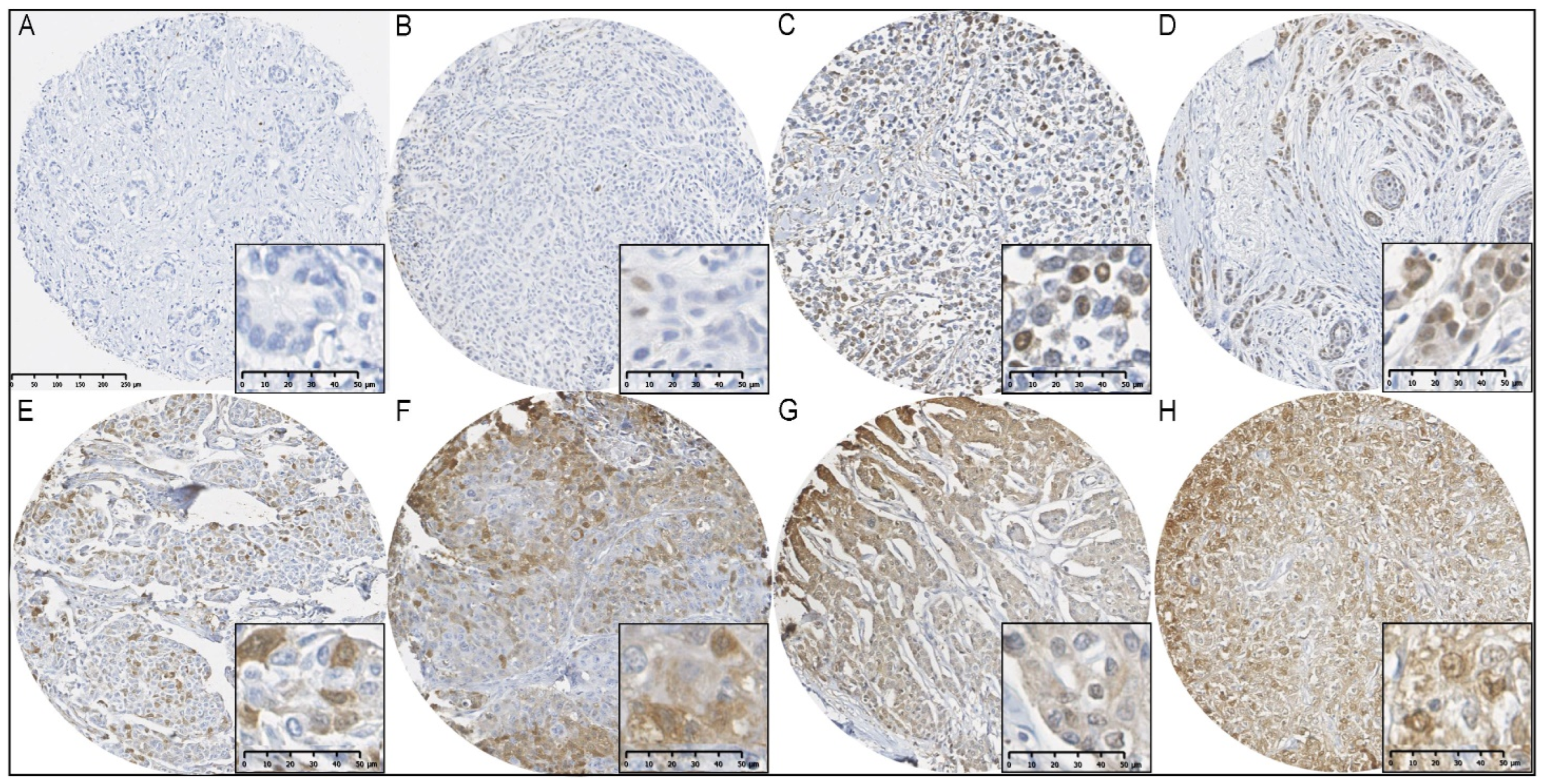 Cancers 16 00028 g001