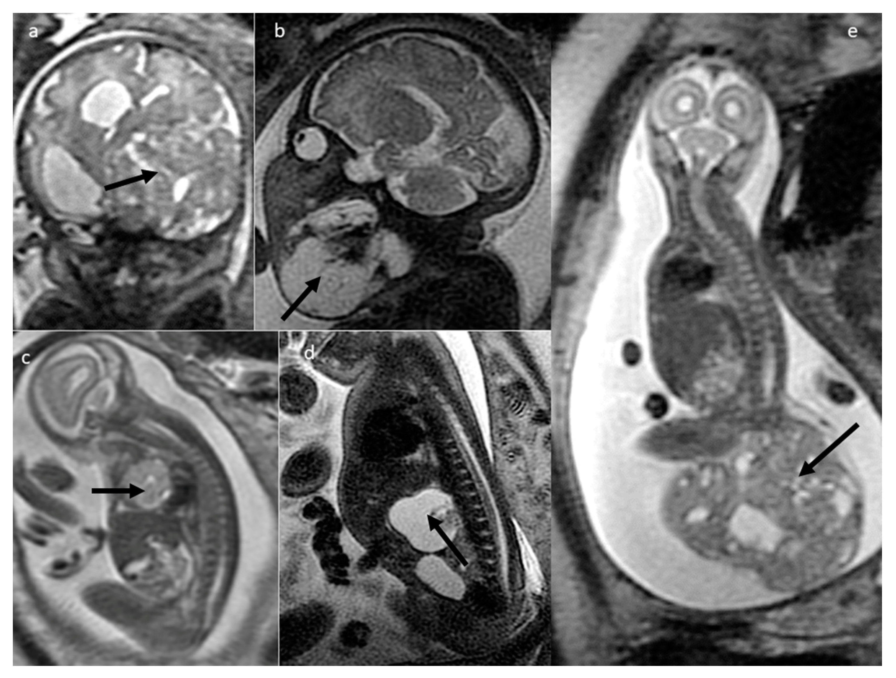 Cancers 16 00043 g003 Cancers 16 00043 g003