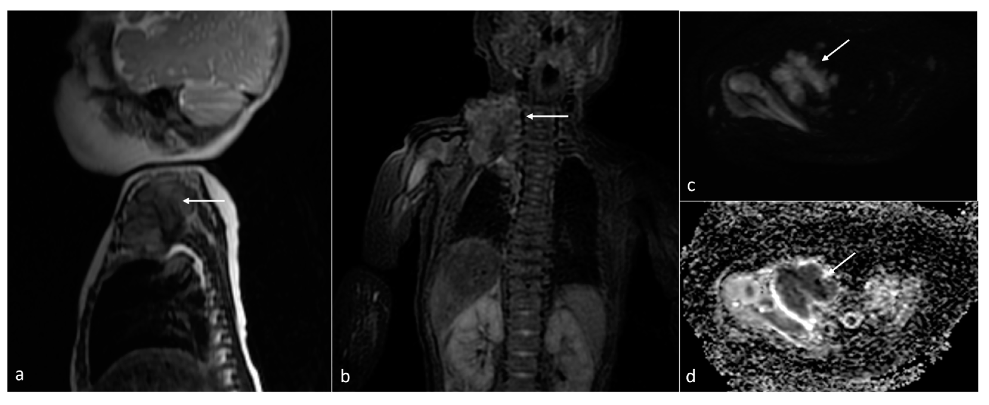 Cancers 16 00043 g006 Cancers 16 00043 g006