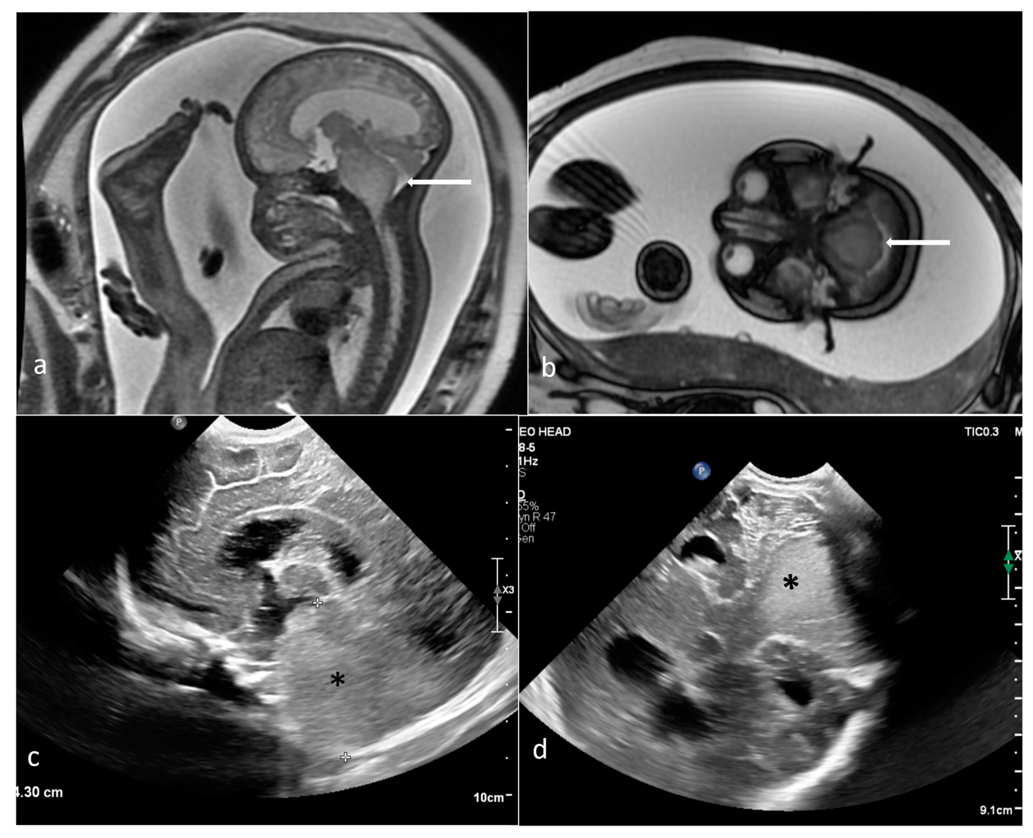 Cancers 16 00043 g008 Cancers 16 00043 g008