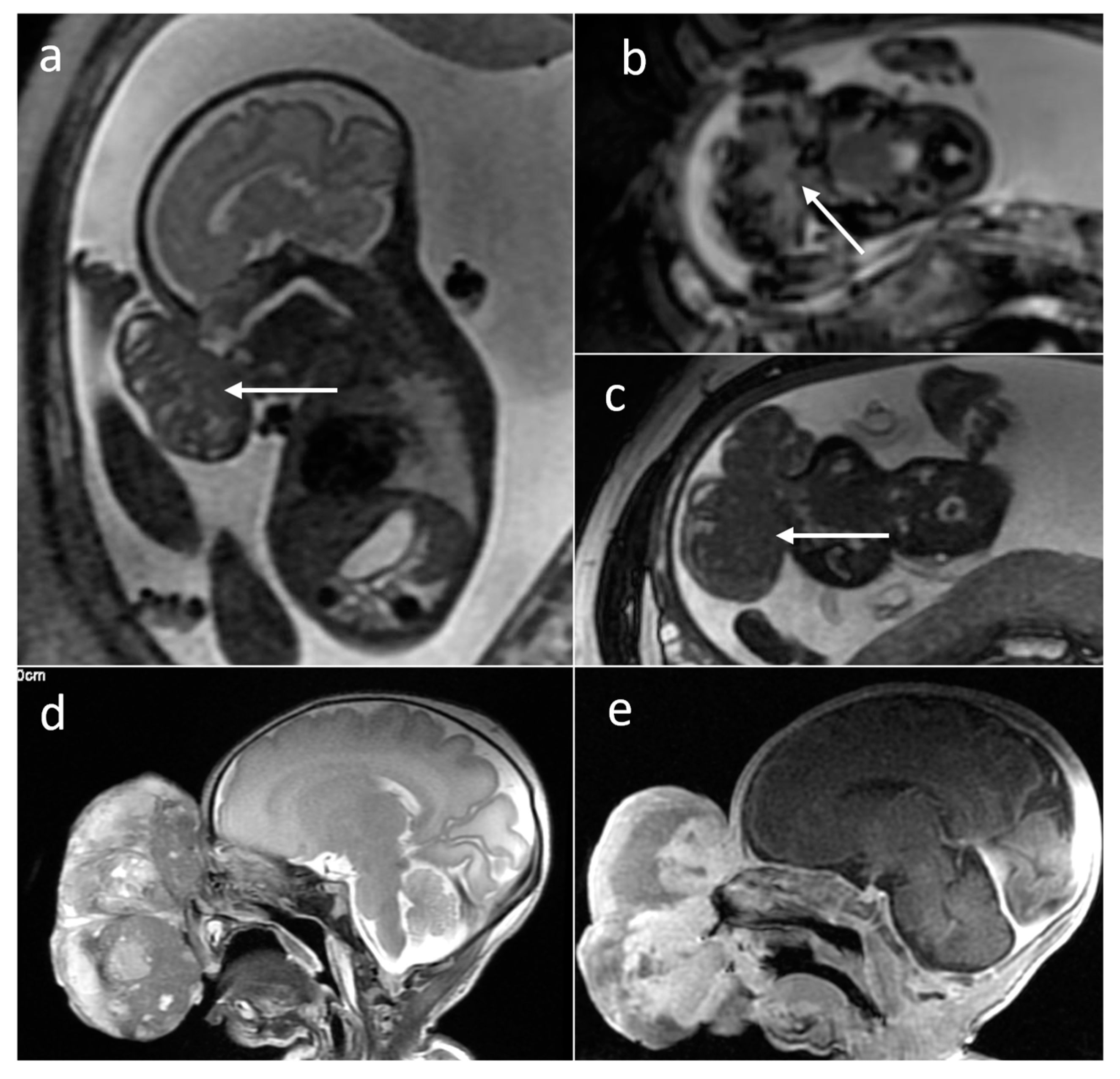 Cancers 16 00043 g009 Cancers 16 00043 g009