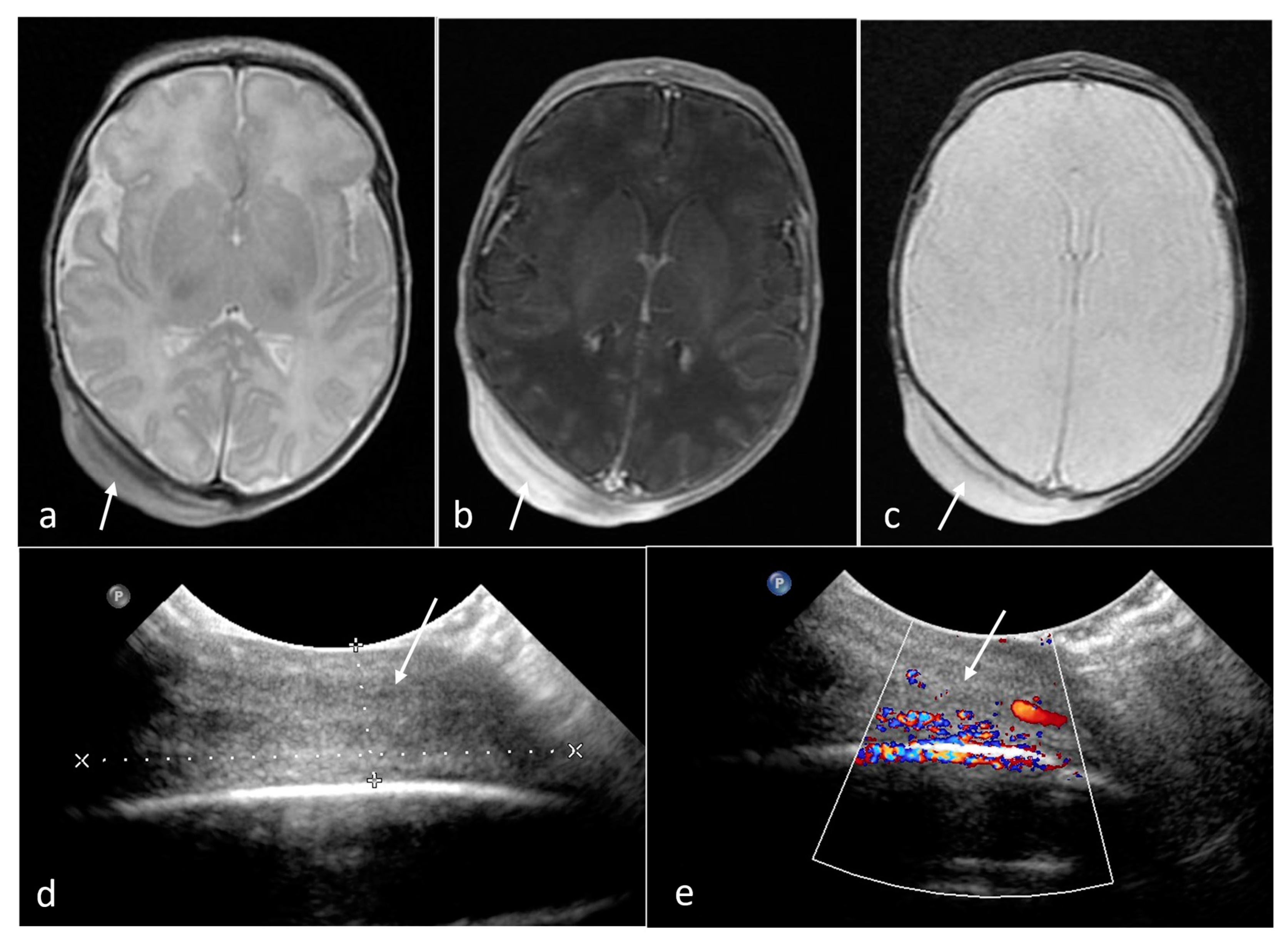 Cancers 16 00043 g011 Cancers 16 00043 g011