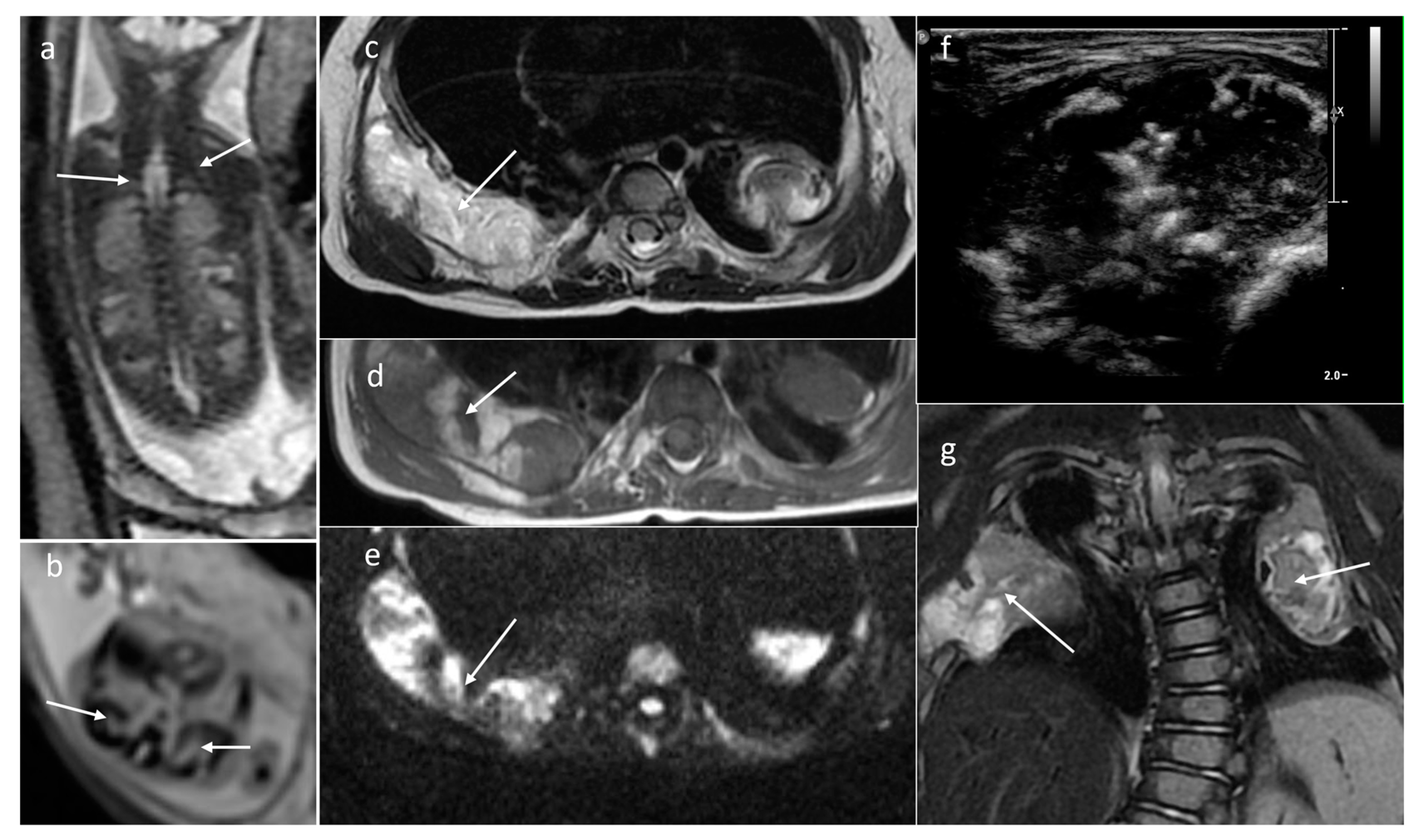 Cancers 16 00043 g012 Cancers 16 00043 g012