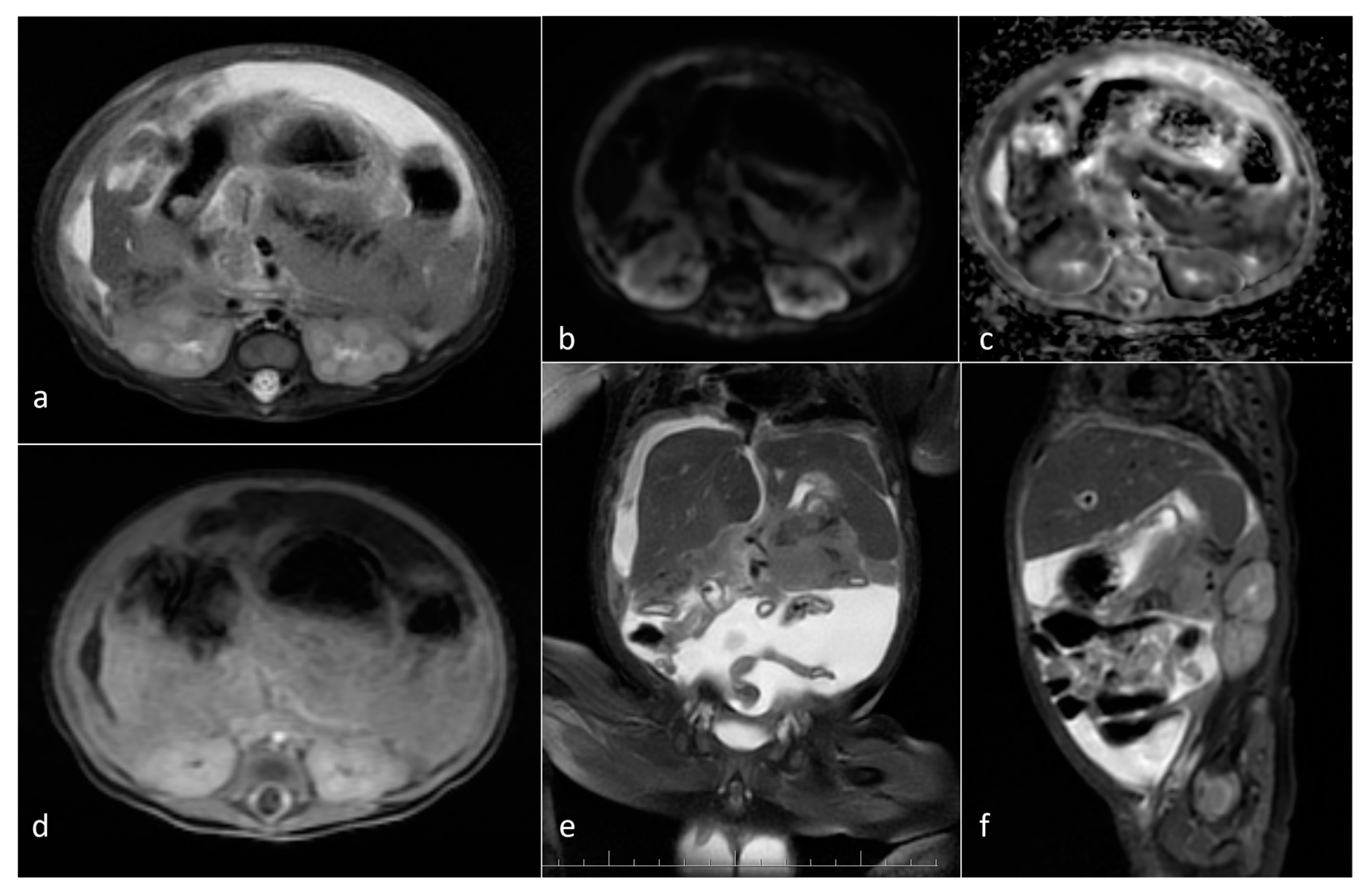 Cancers 16 00043 g013 Cancers 16 00043 g013