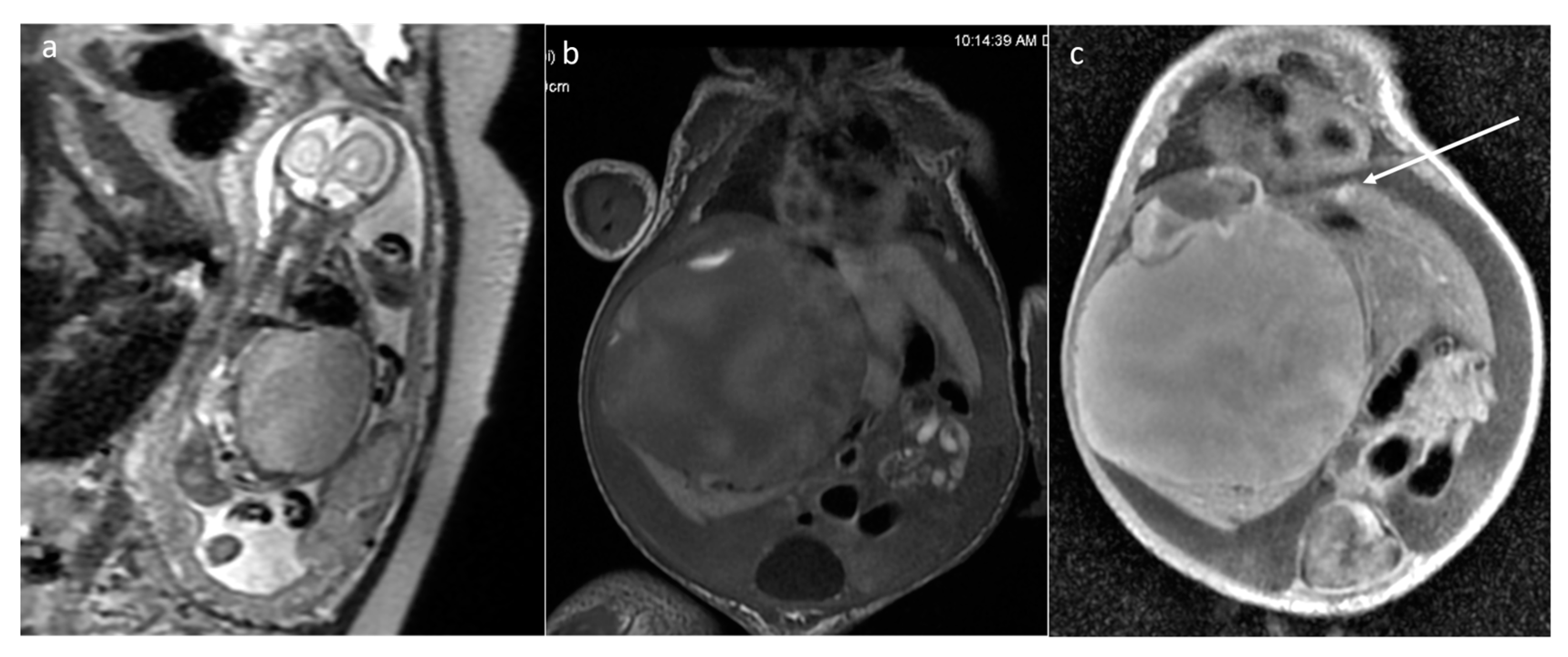 Cancers 16 00043 g014 Cancers 16 00043 g014