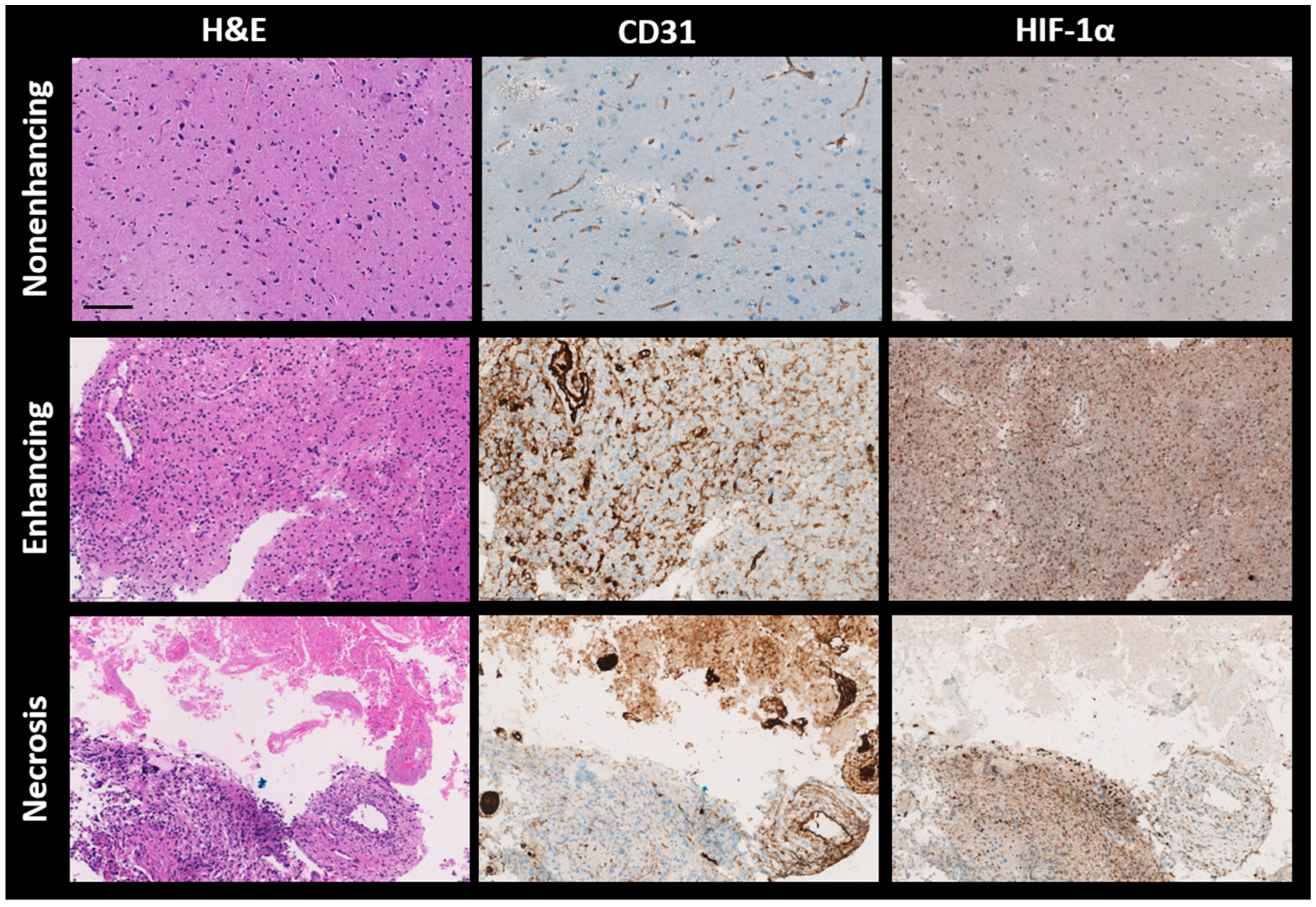 Cancers 16 00138 g005