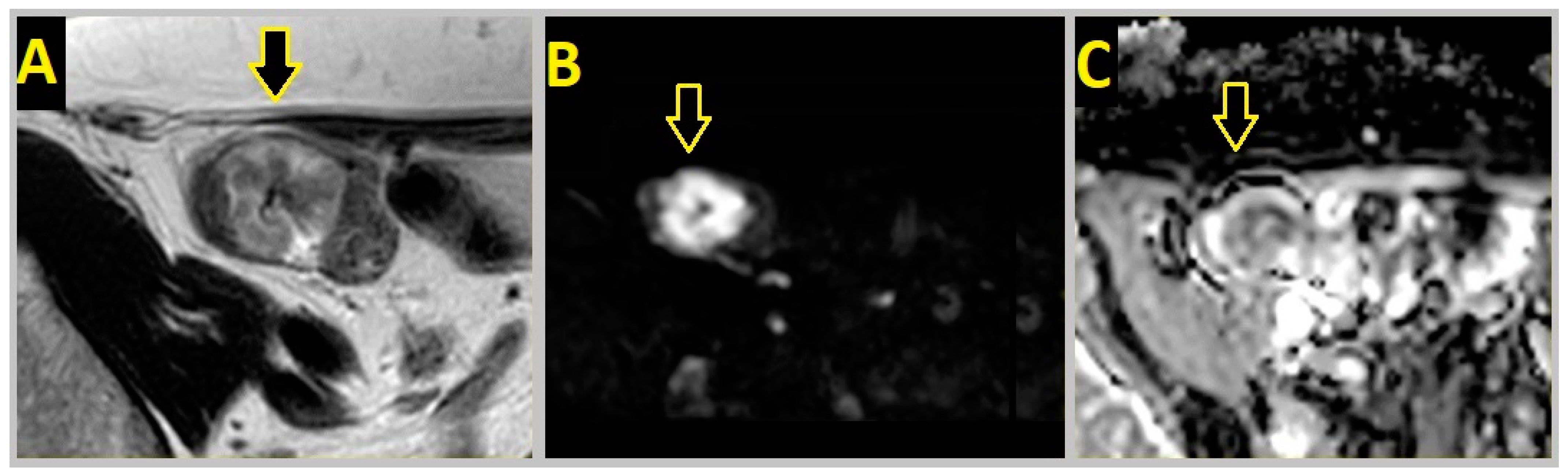 Cancers 16 00144 g003 Cancers 16 00144 g003