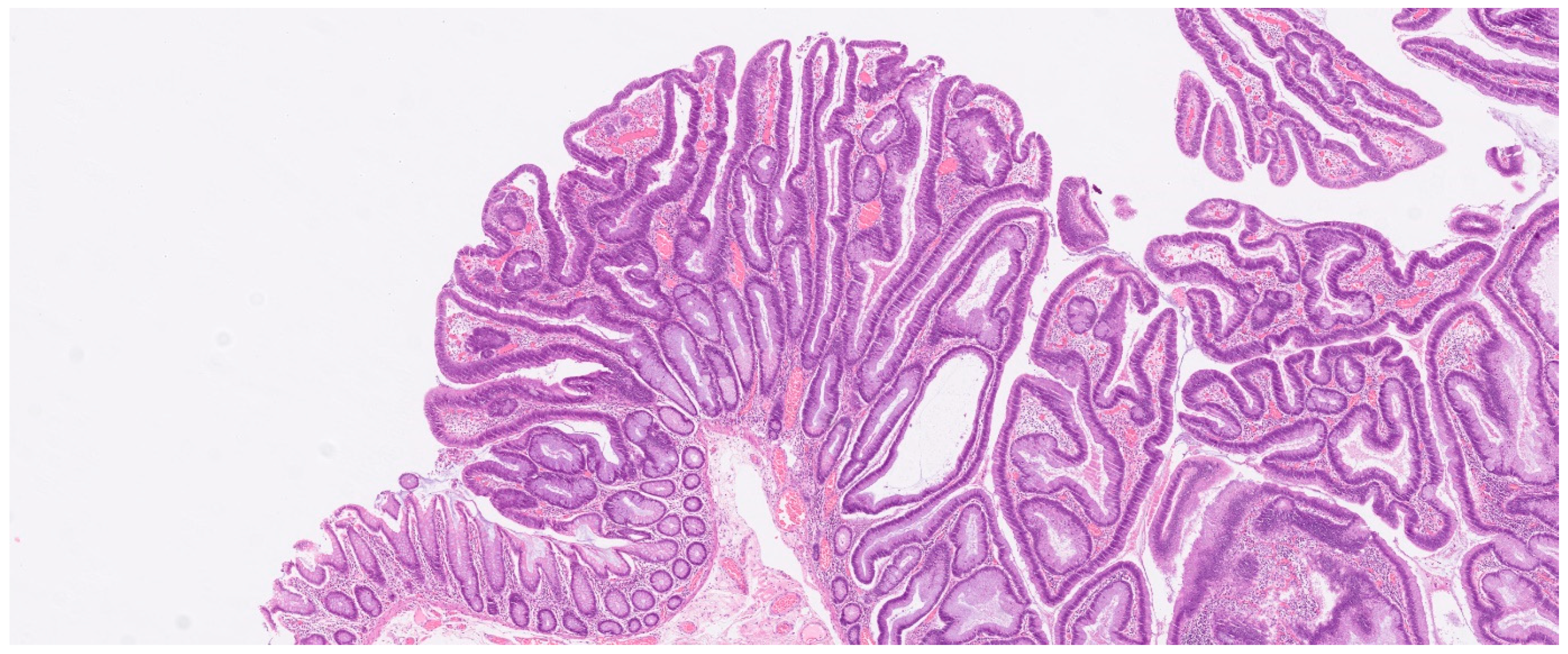 Cancers 16 00144 g004 Cancers 16 00144 g004