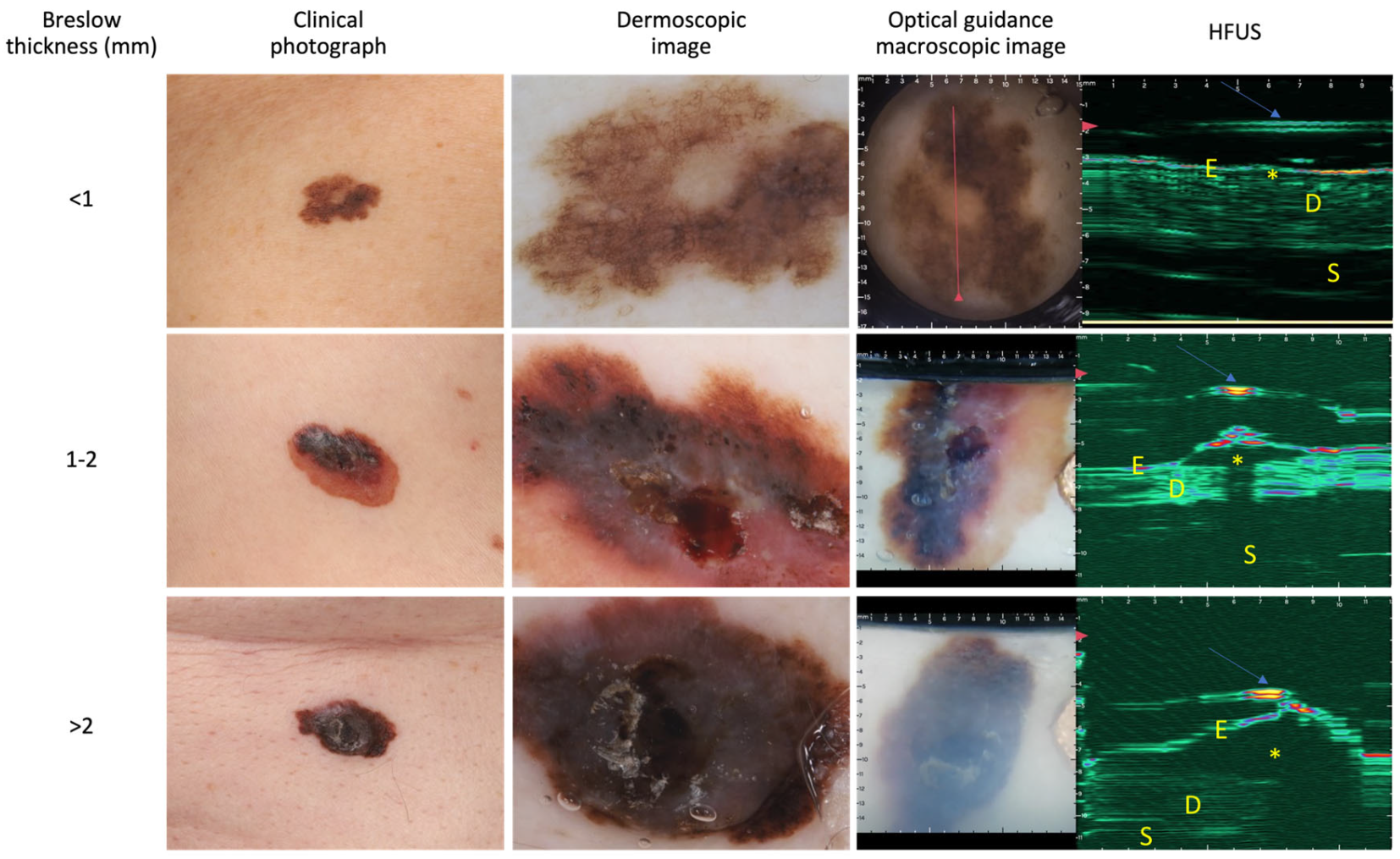 Cancers 16 00157 g002