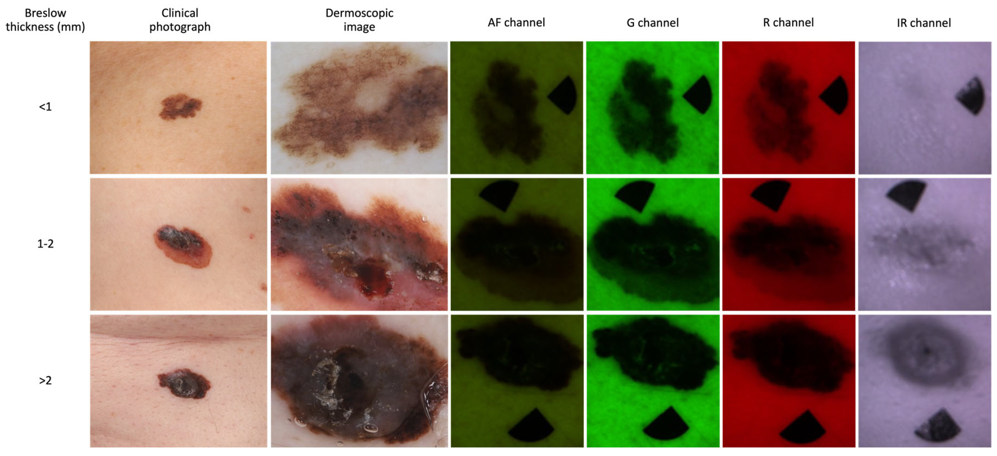 Cancers 16 00157 g004