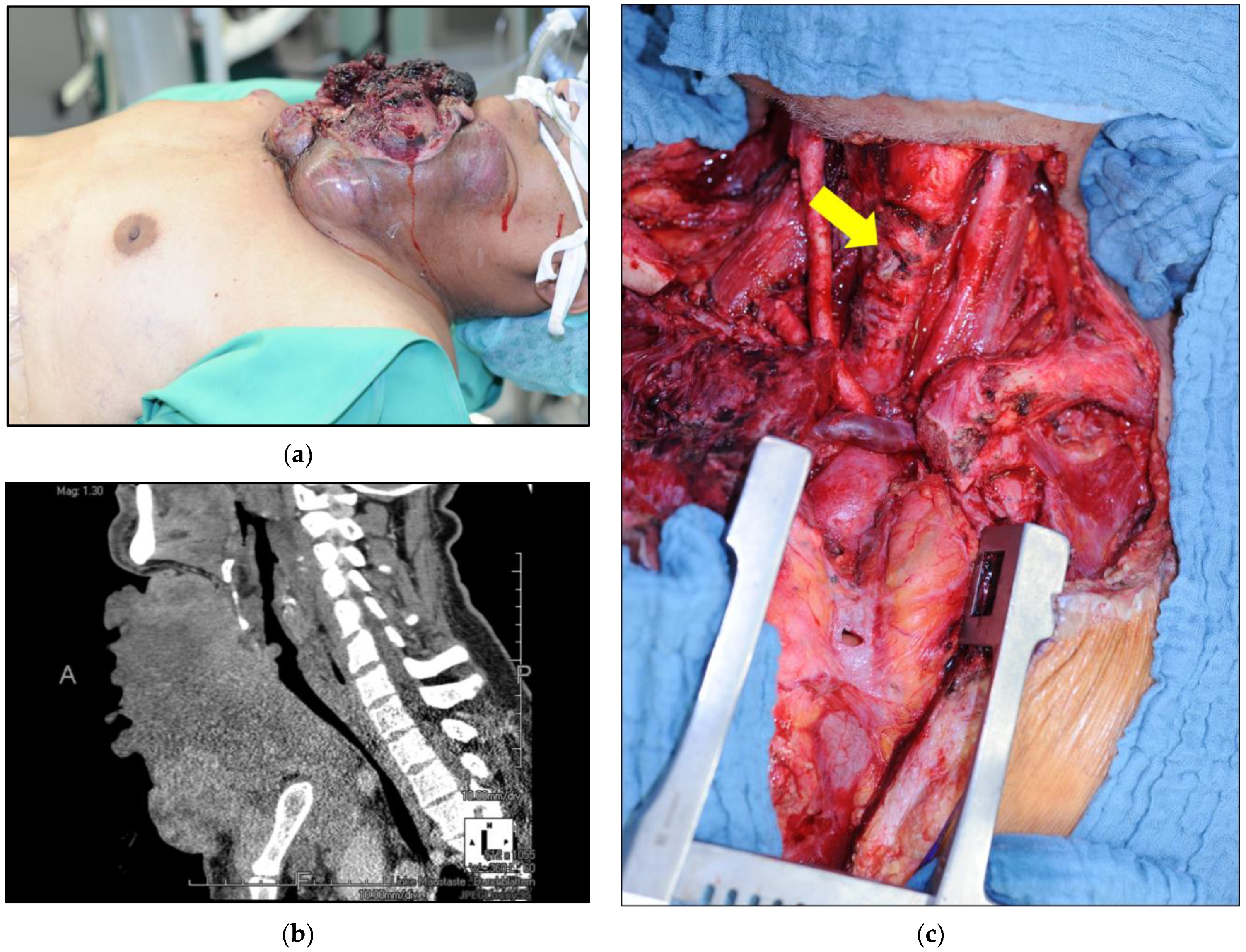 Cancers 16 00163 g004