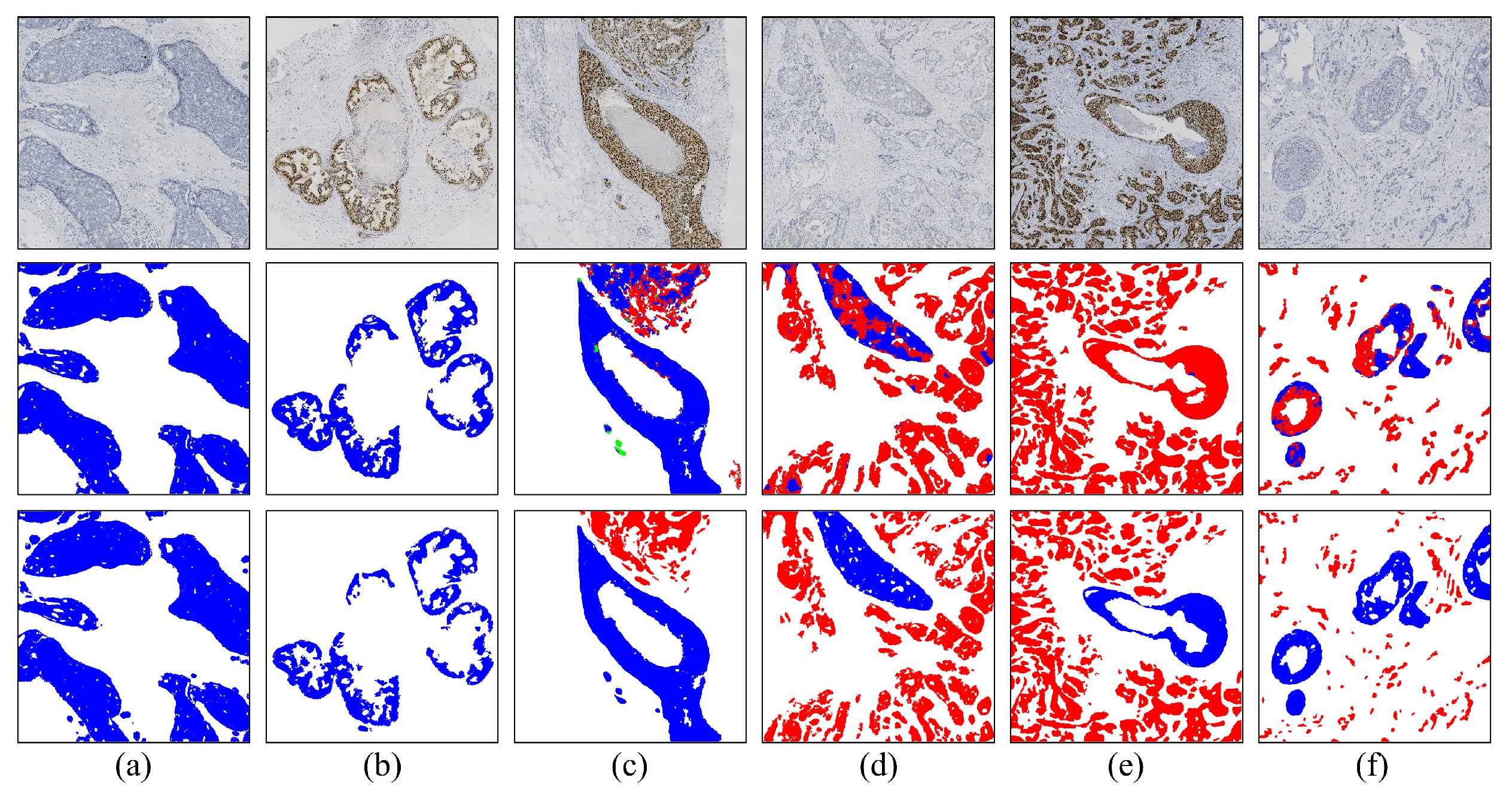 Cancers 16 00167 g005