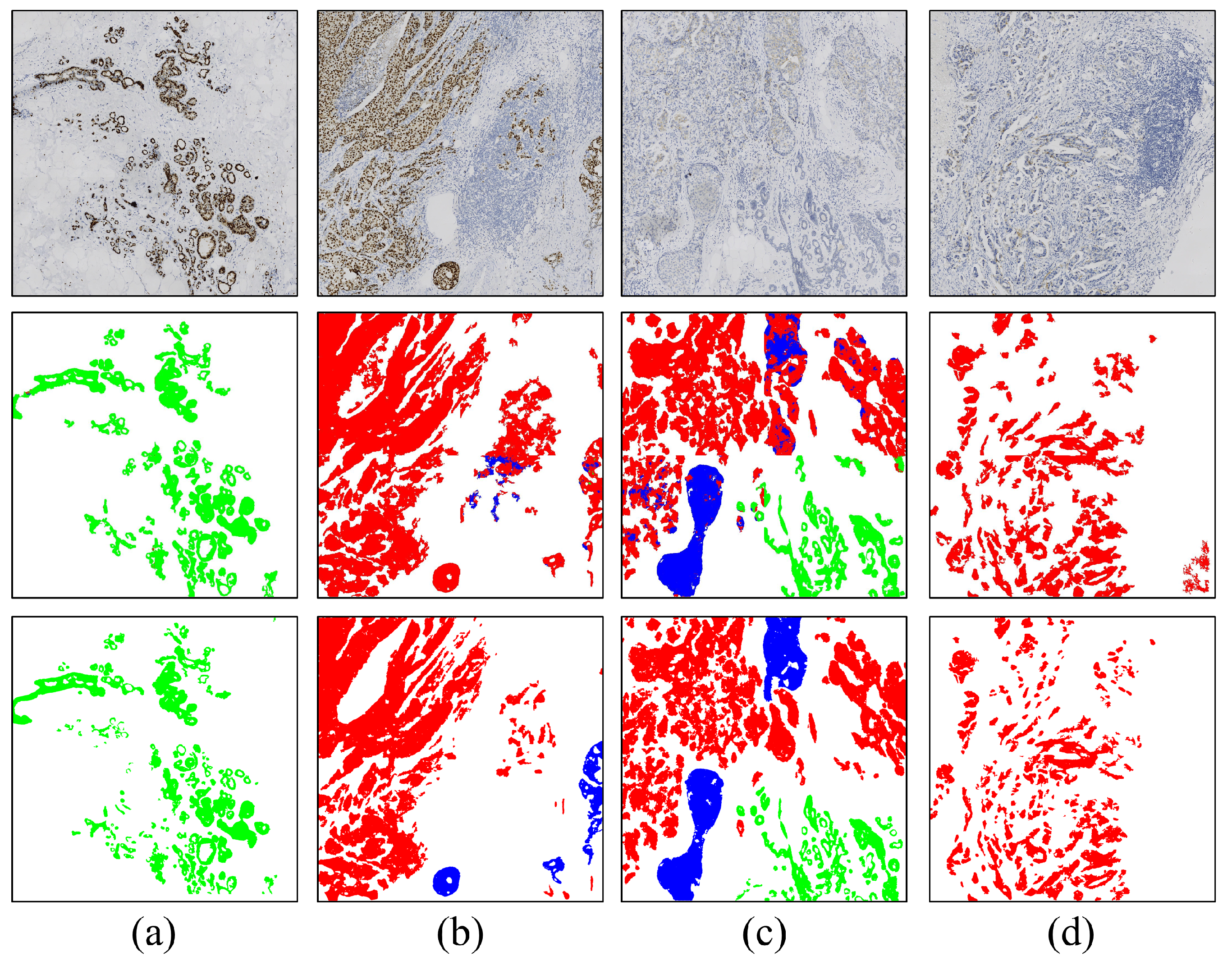 Cancers 16 00167 g006