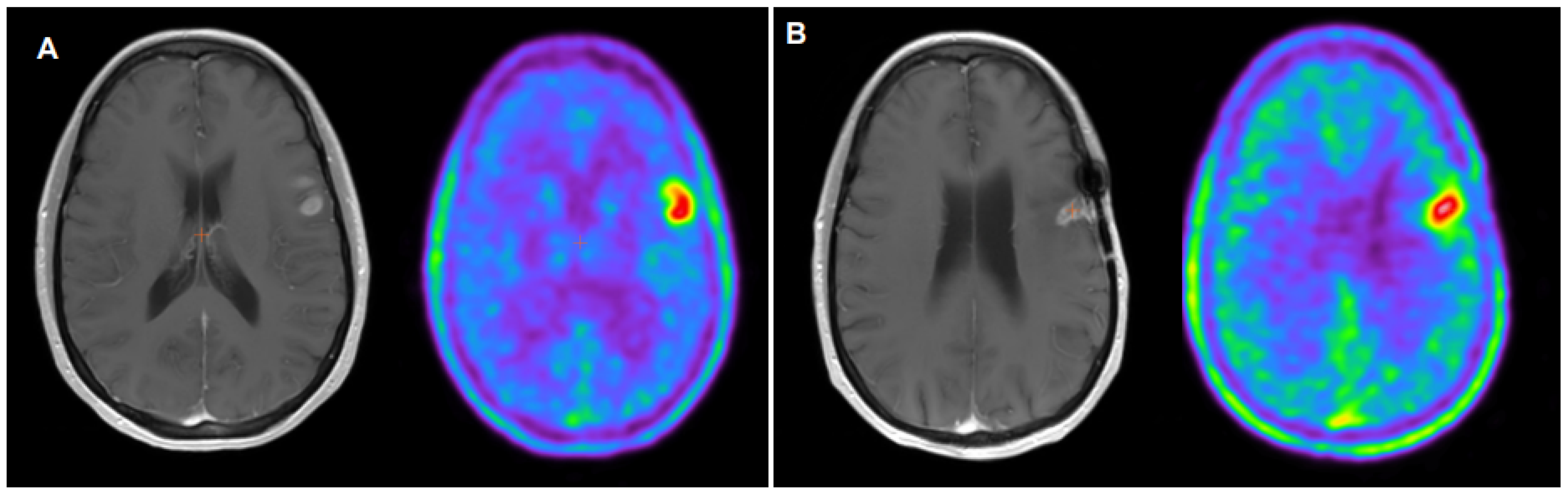 Cancers 16 00195 g001