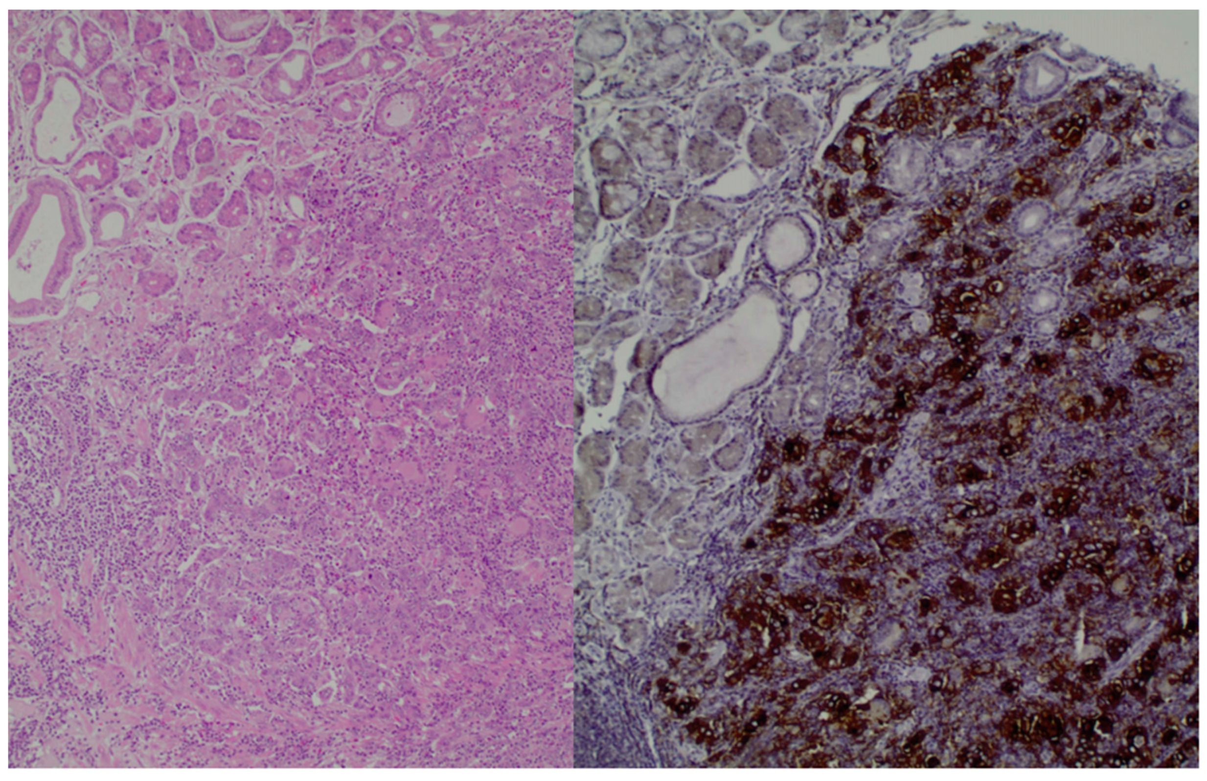 Cancers 16 00196 g001