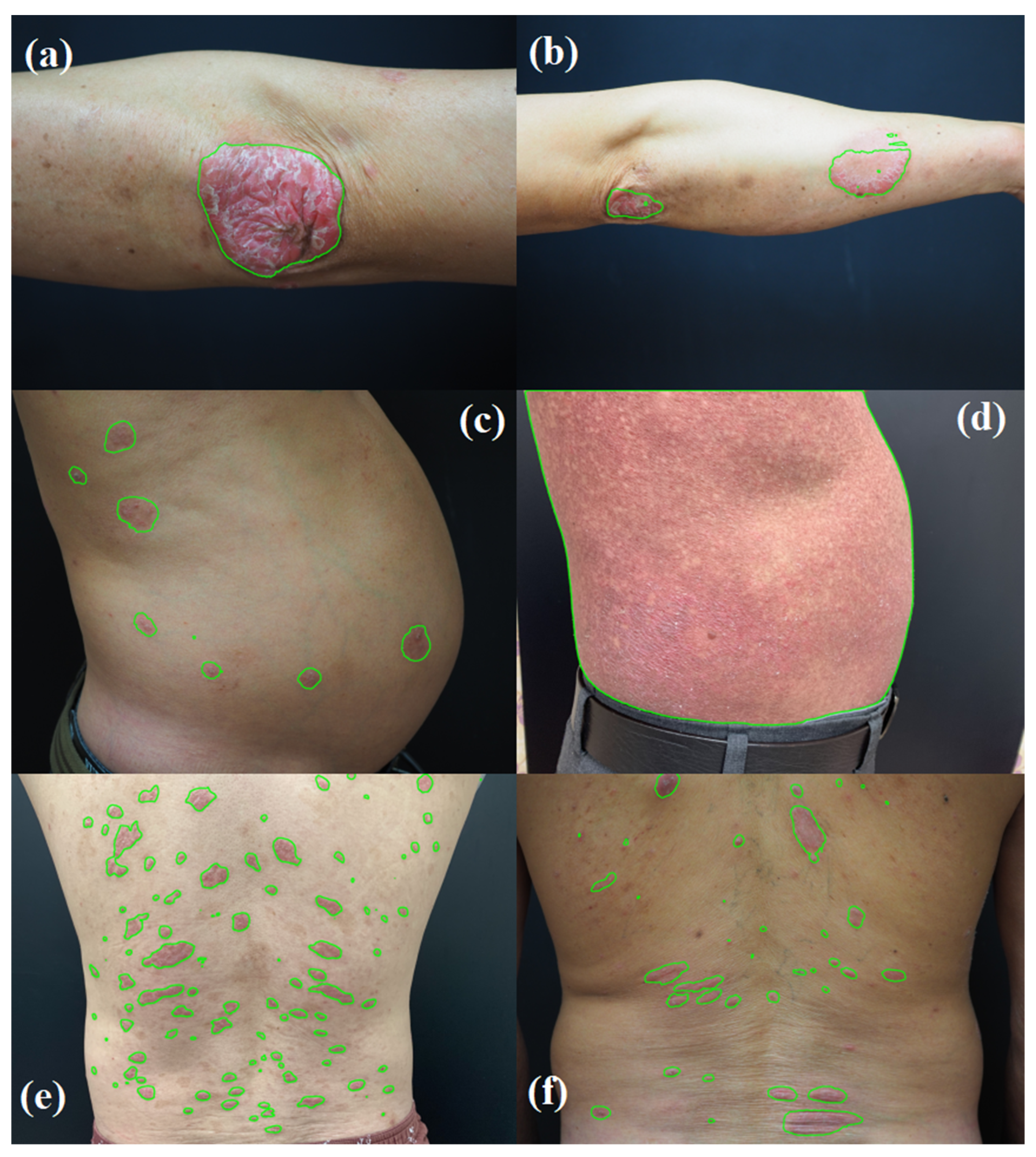 Cancers 16 00217 g010