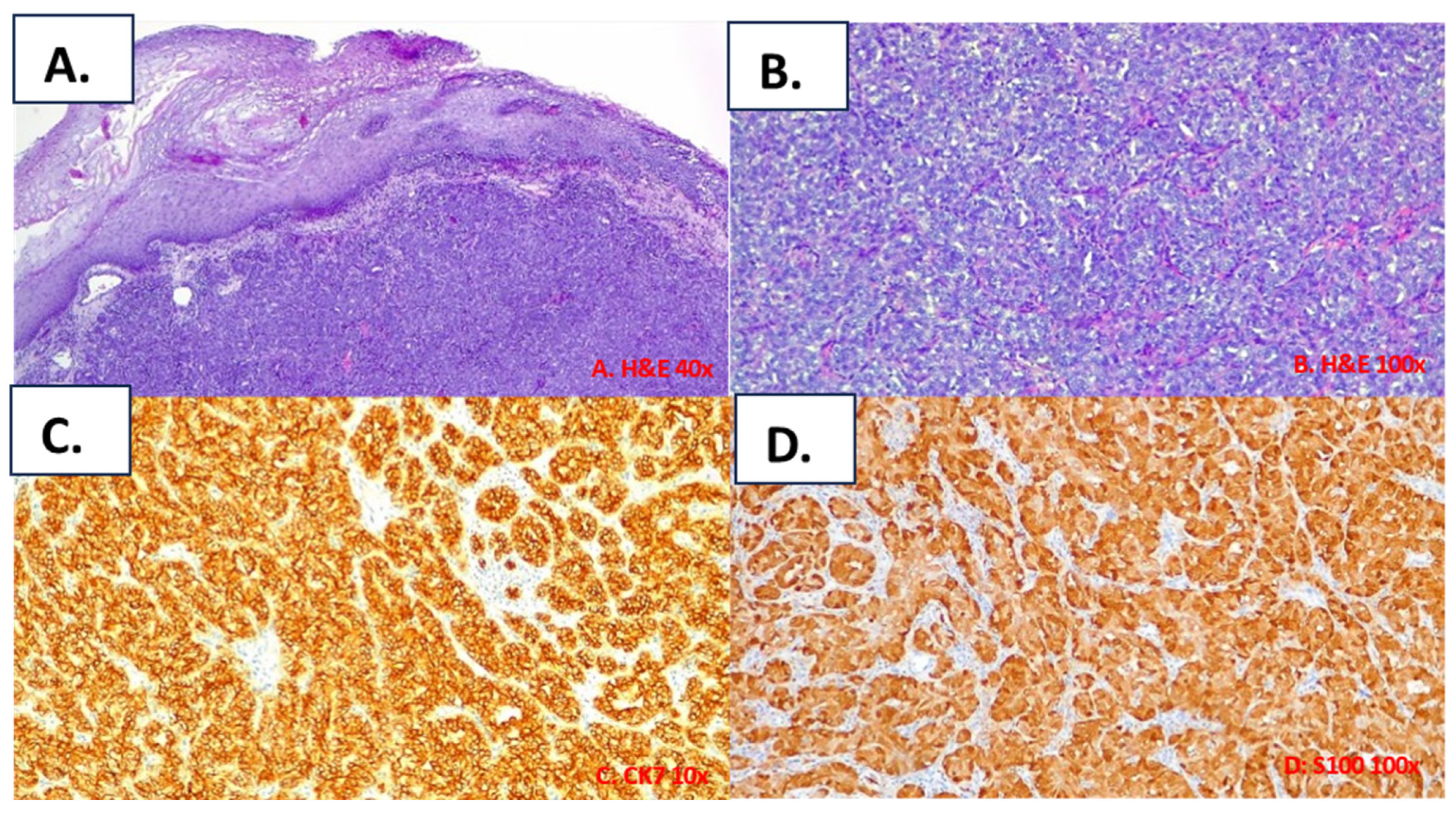 Cancers 16 00220 g003