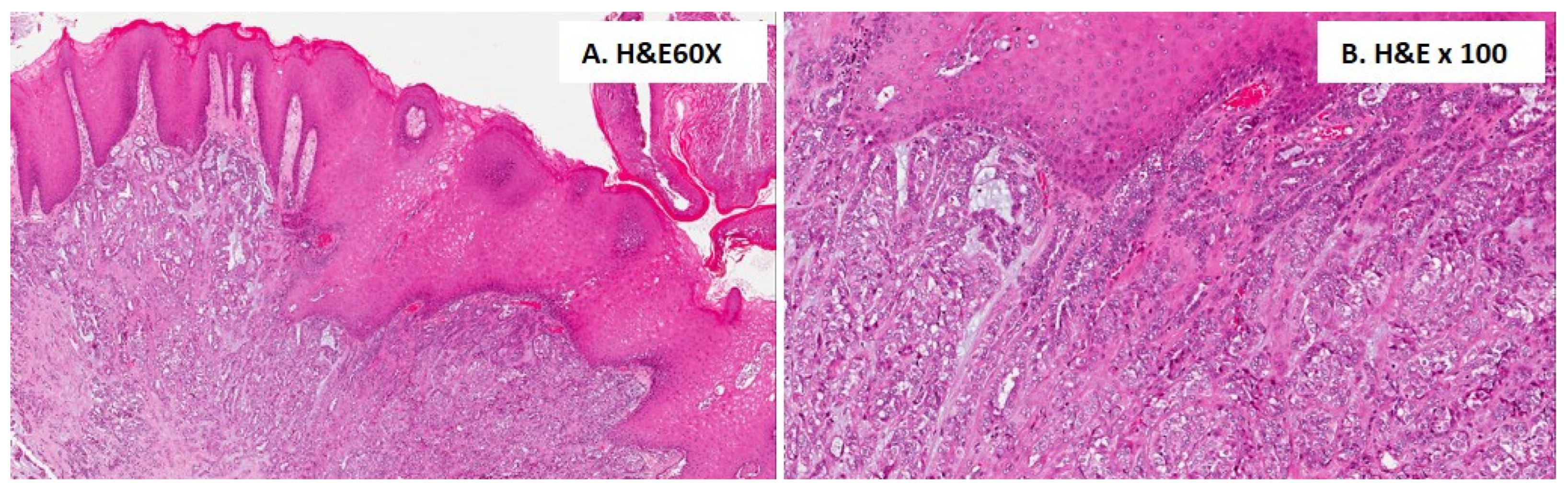 Cancers 16 00220 g004