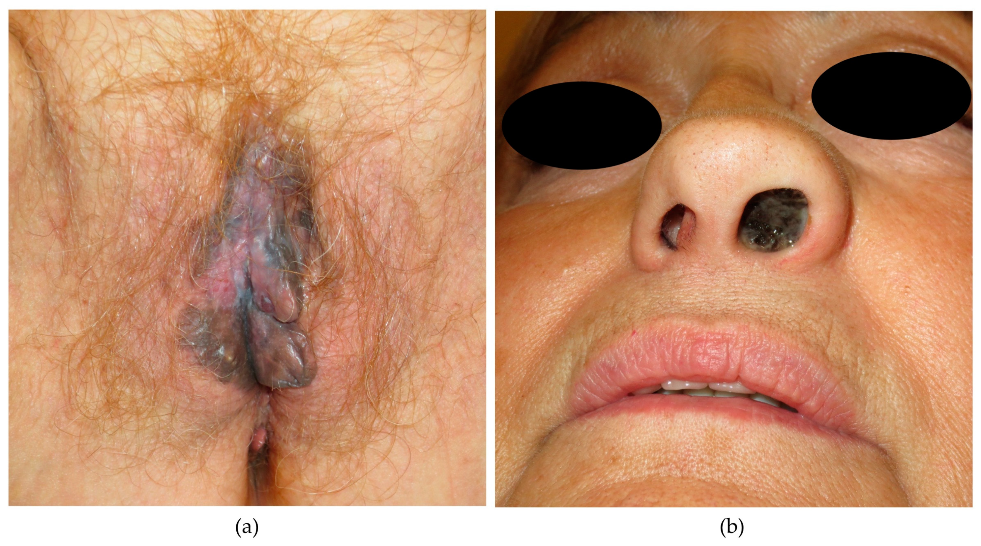 Cancers 16 00227 g001