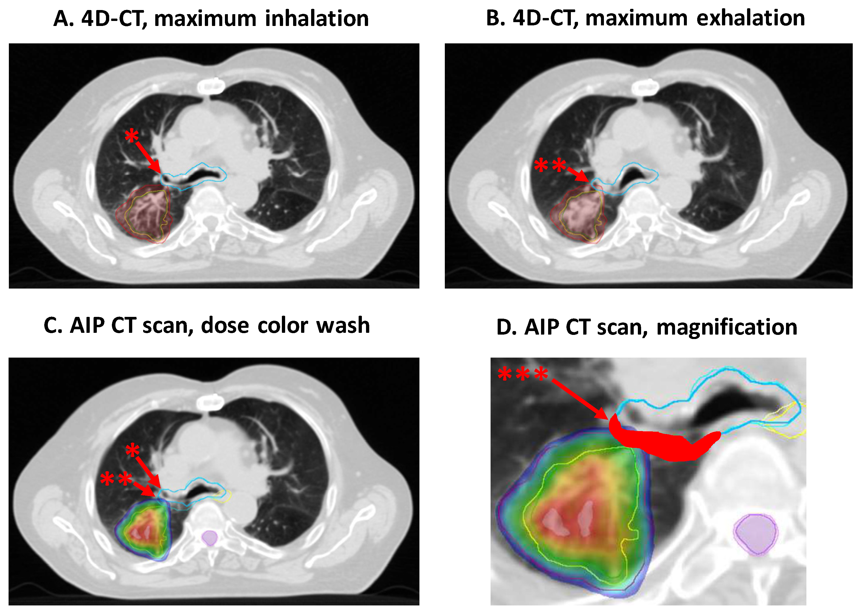 Cancers 16 00231 g005