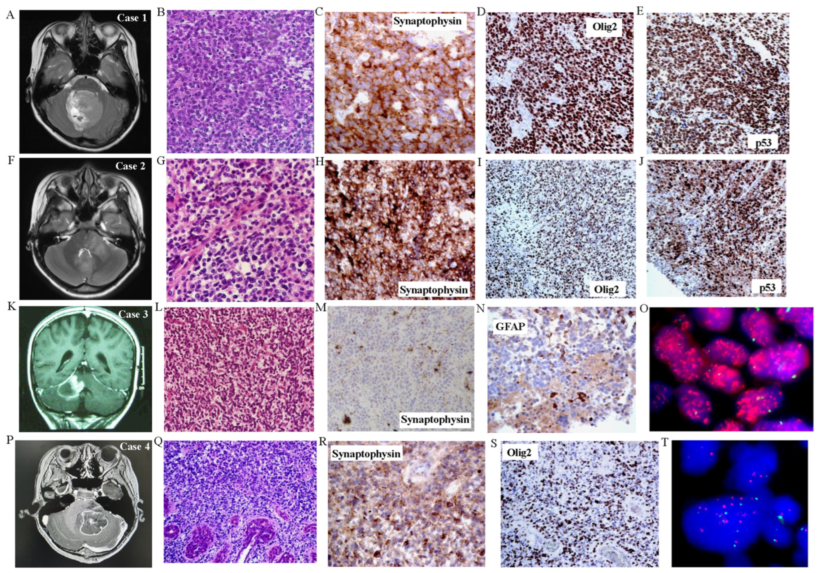 Cancers 16 00232 g001