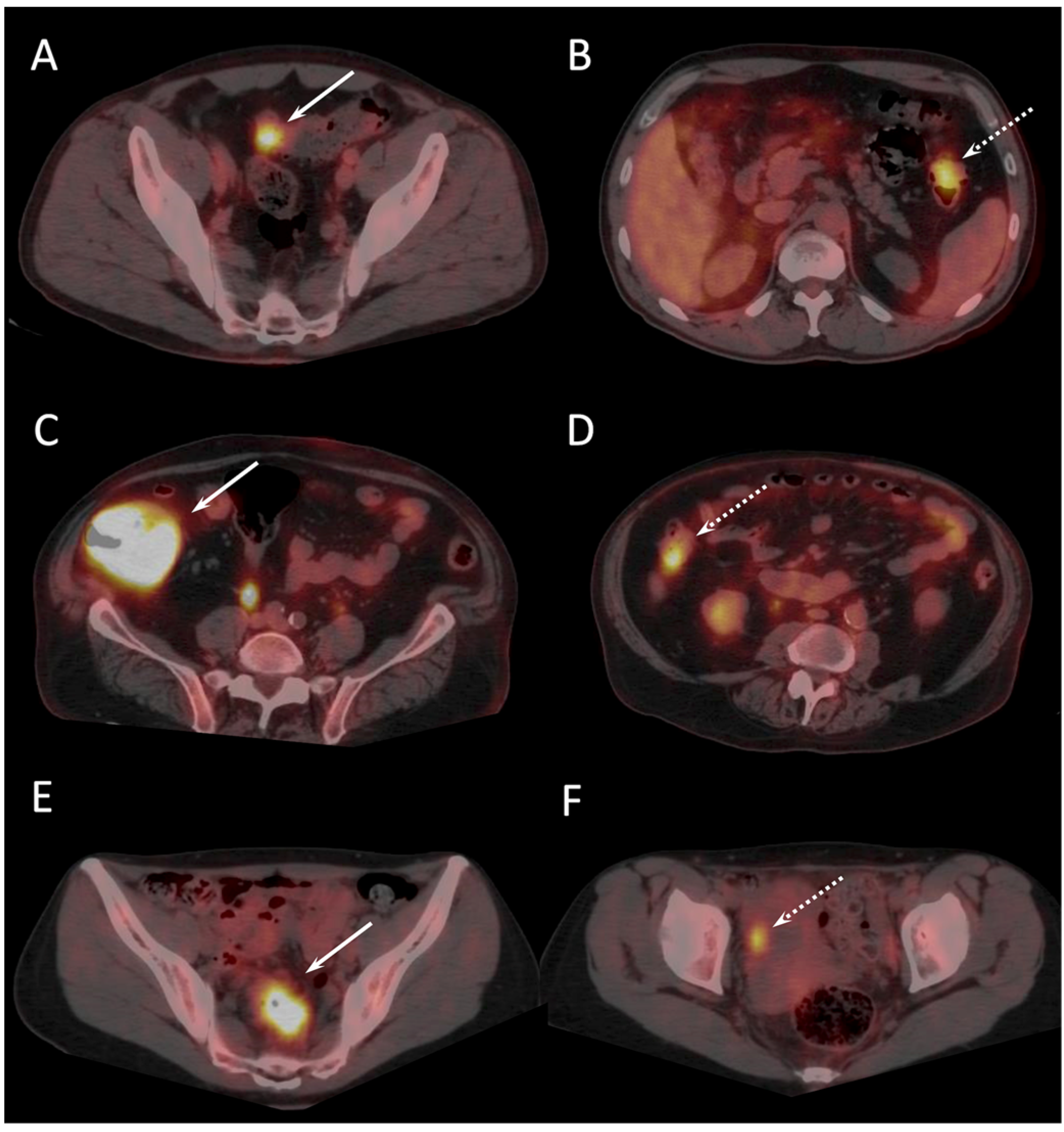 Cancers 16 00233 g001