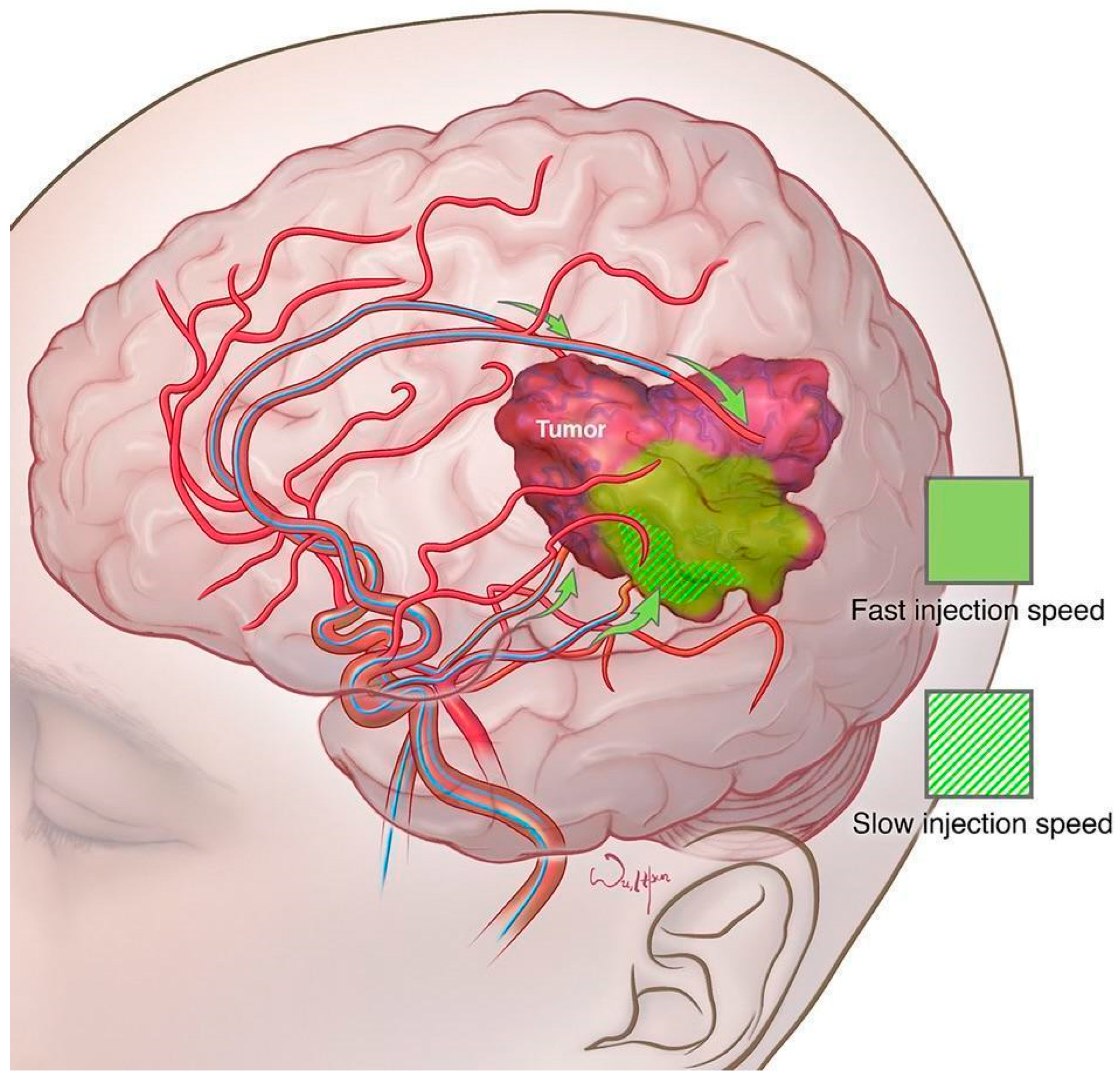 Cancers 16 00236 g005