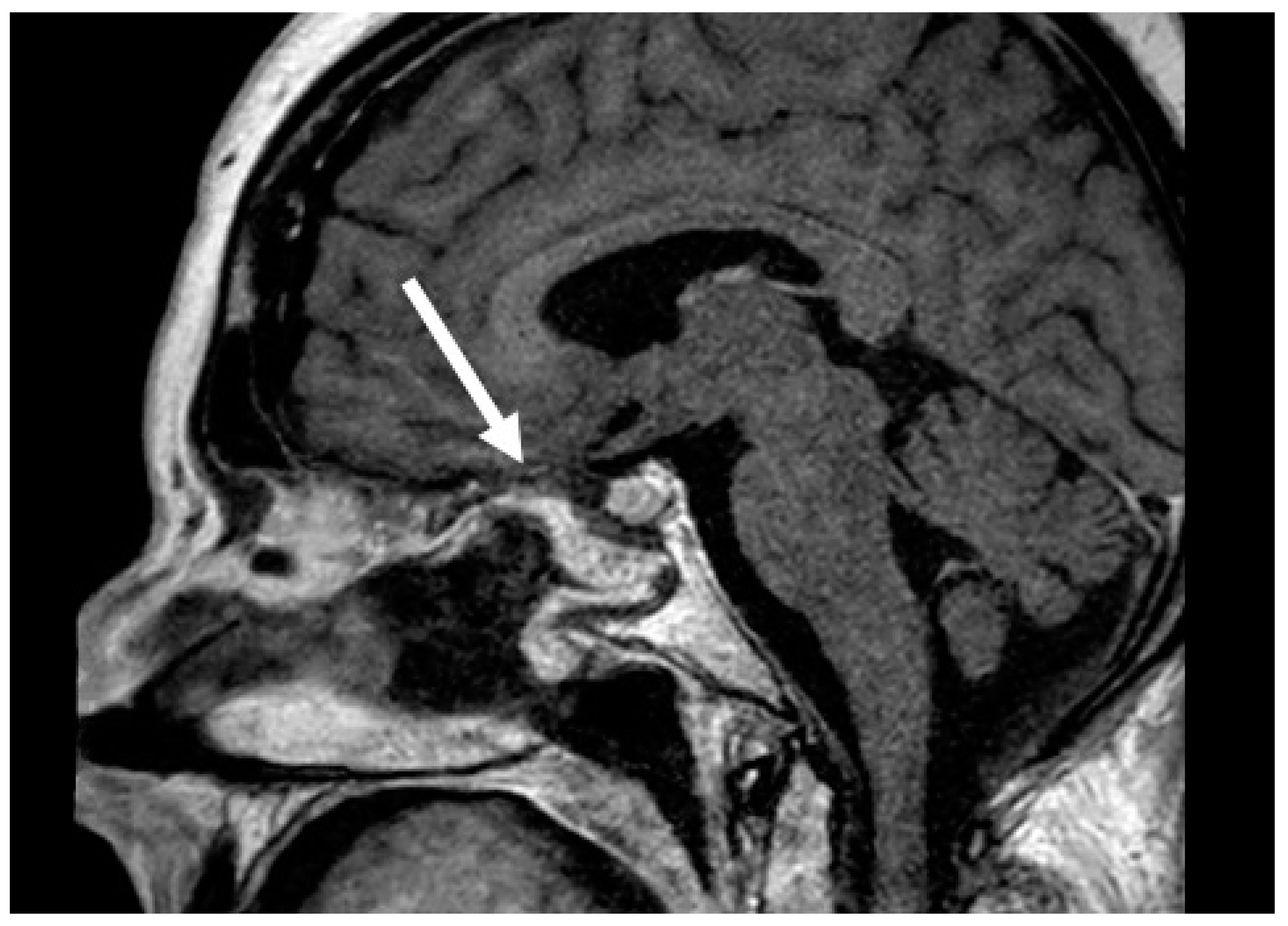 Cancers 16 00242 g002