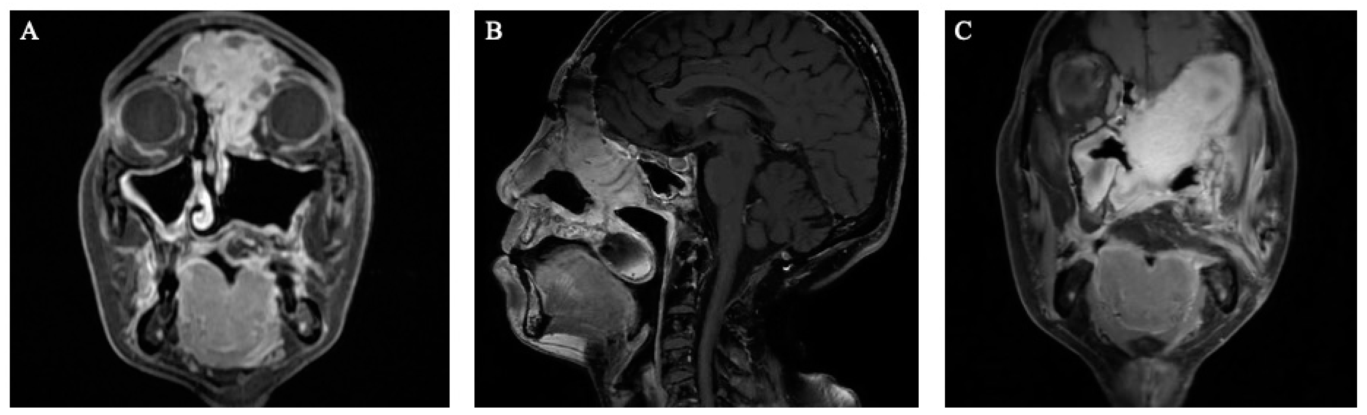 Cancers 16 00242 g003