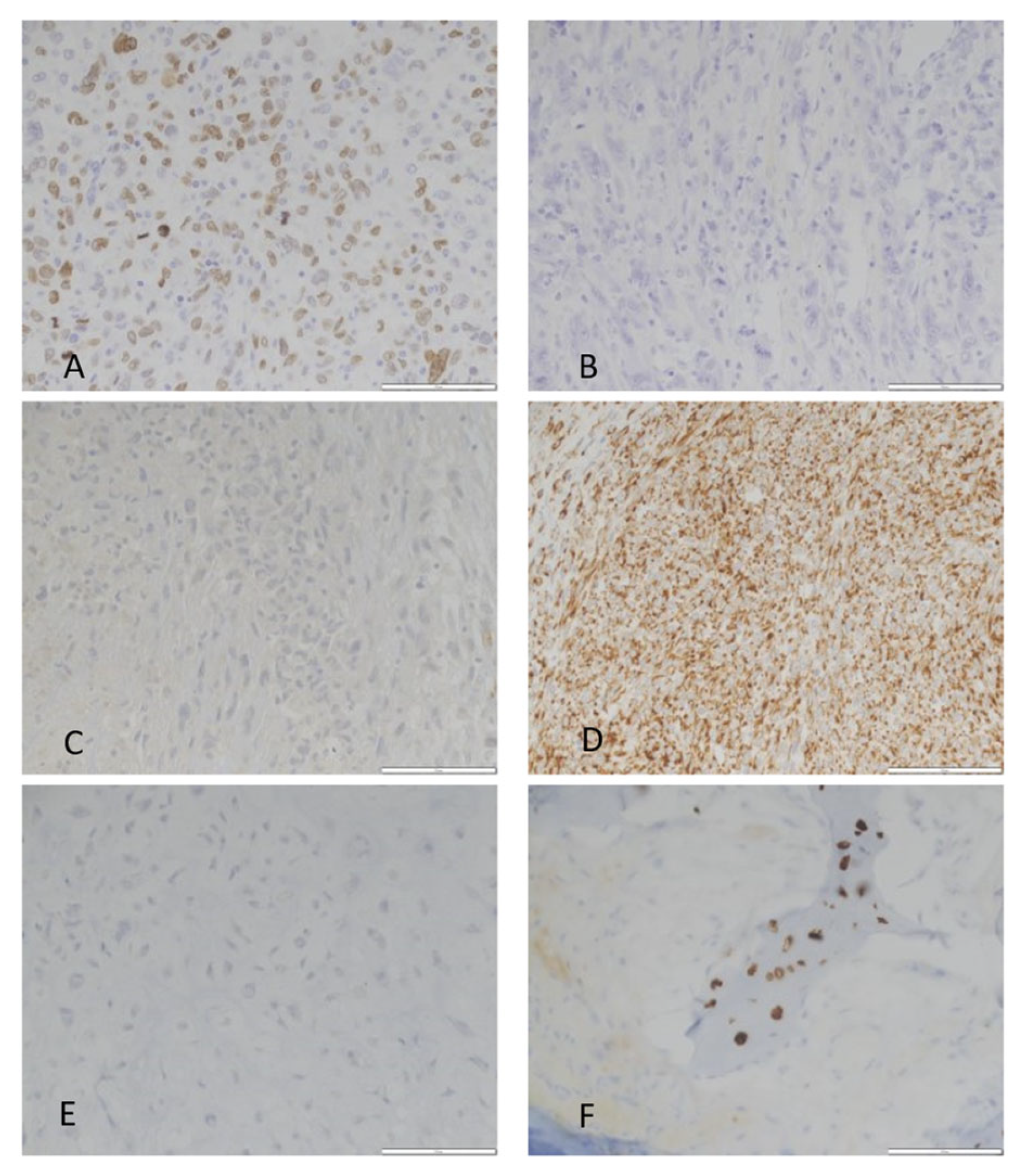 Cancers 16 00247 g002