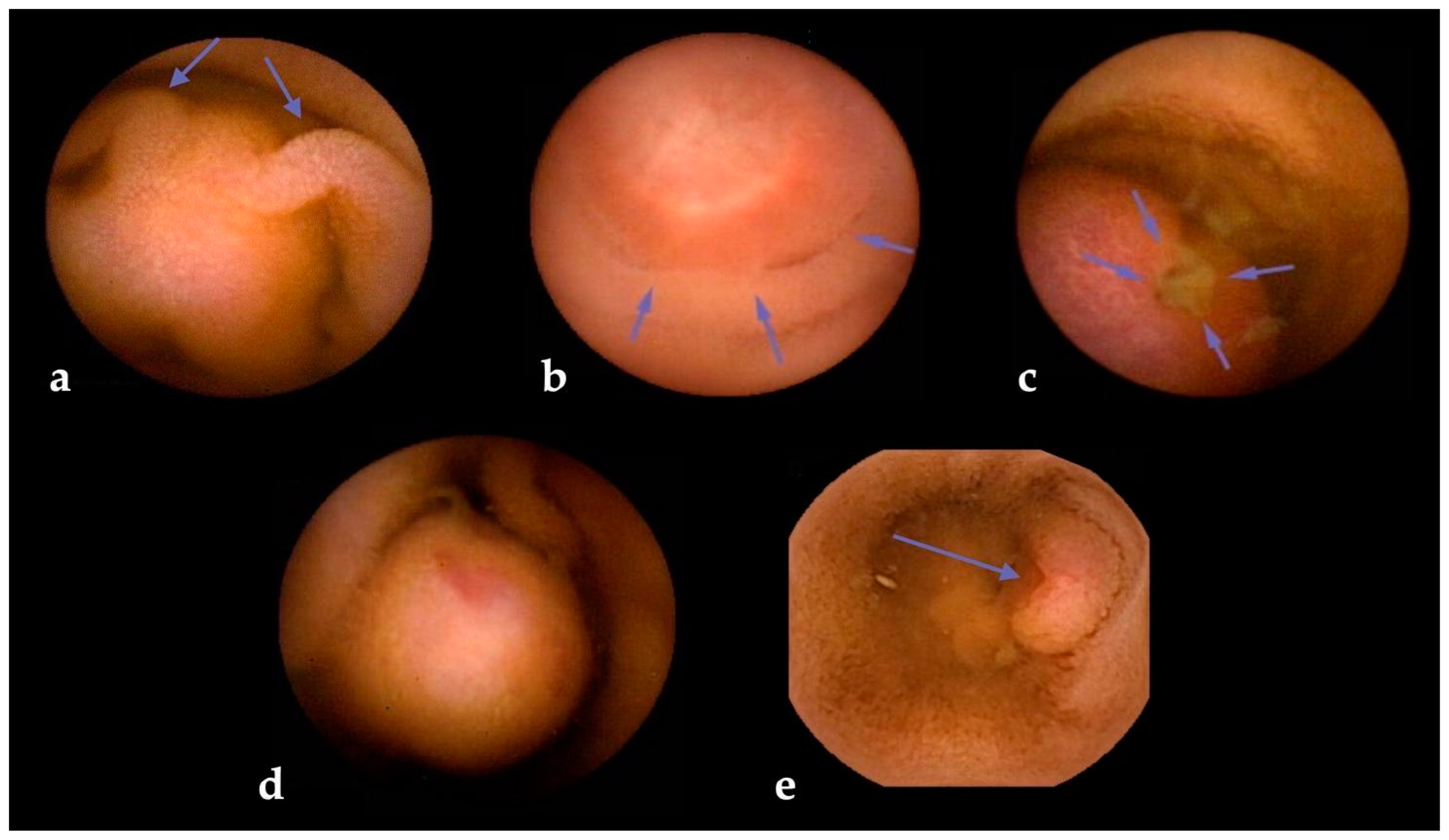 Cancers 16 00262 g003 Cancers 16 00262 g003