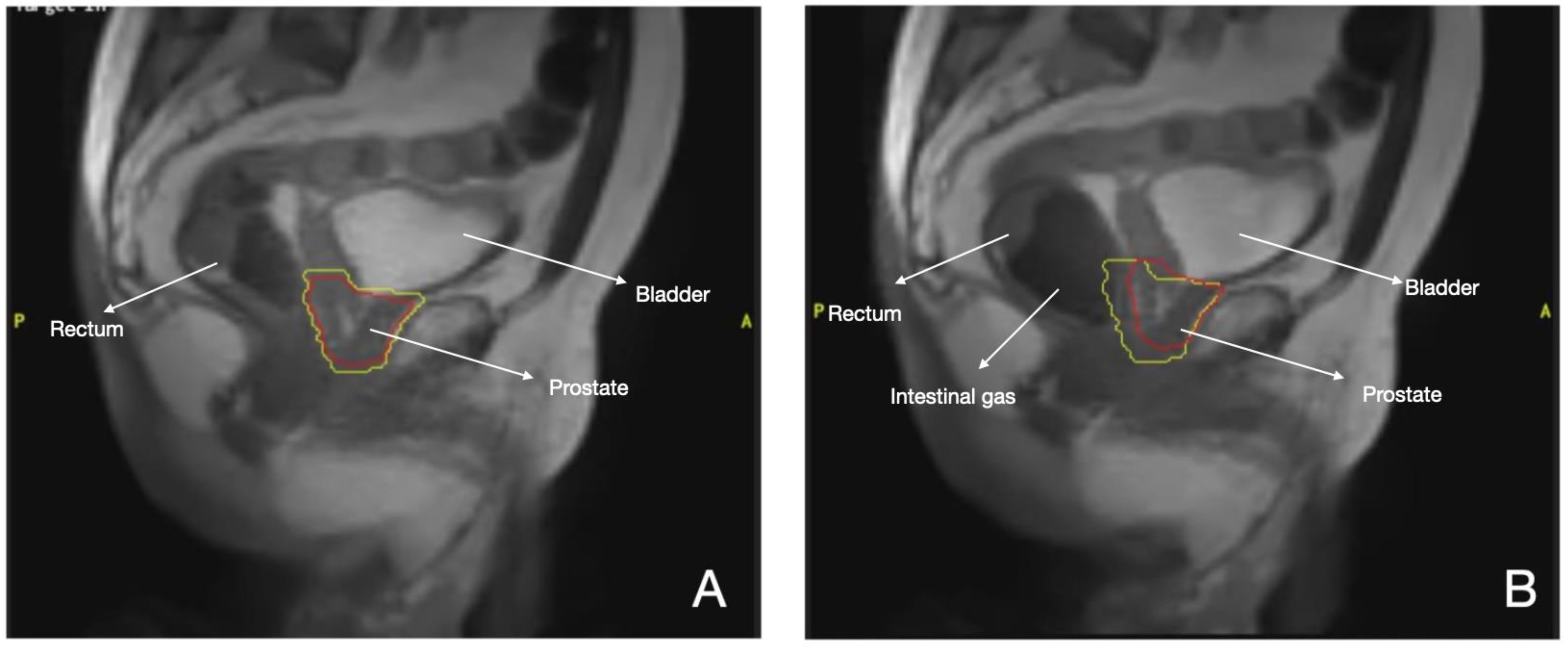 Cancers 16 00270 g001