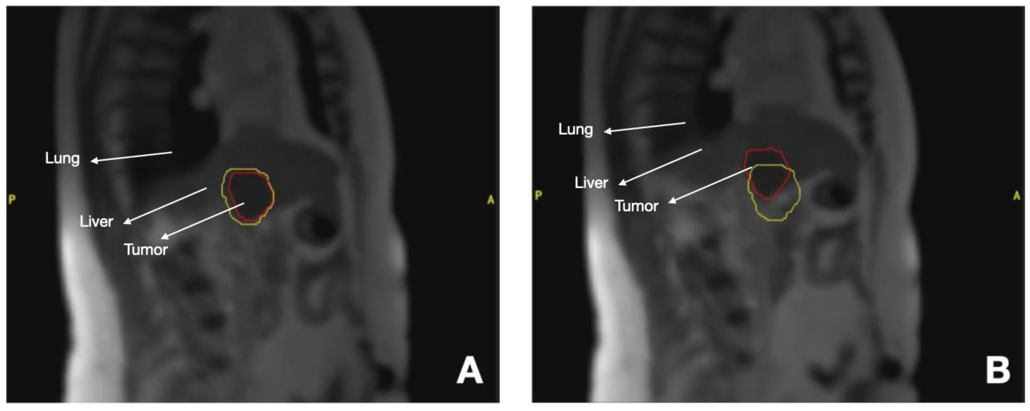 Cancers 16 00270 g002