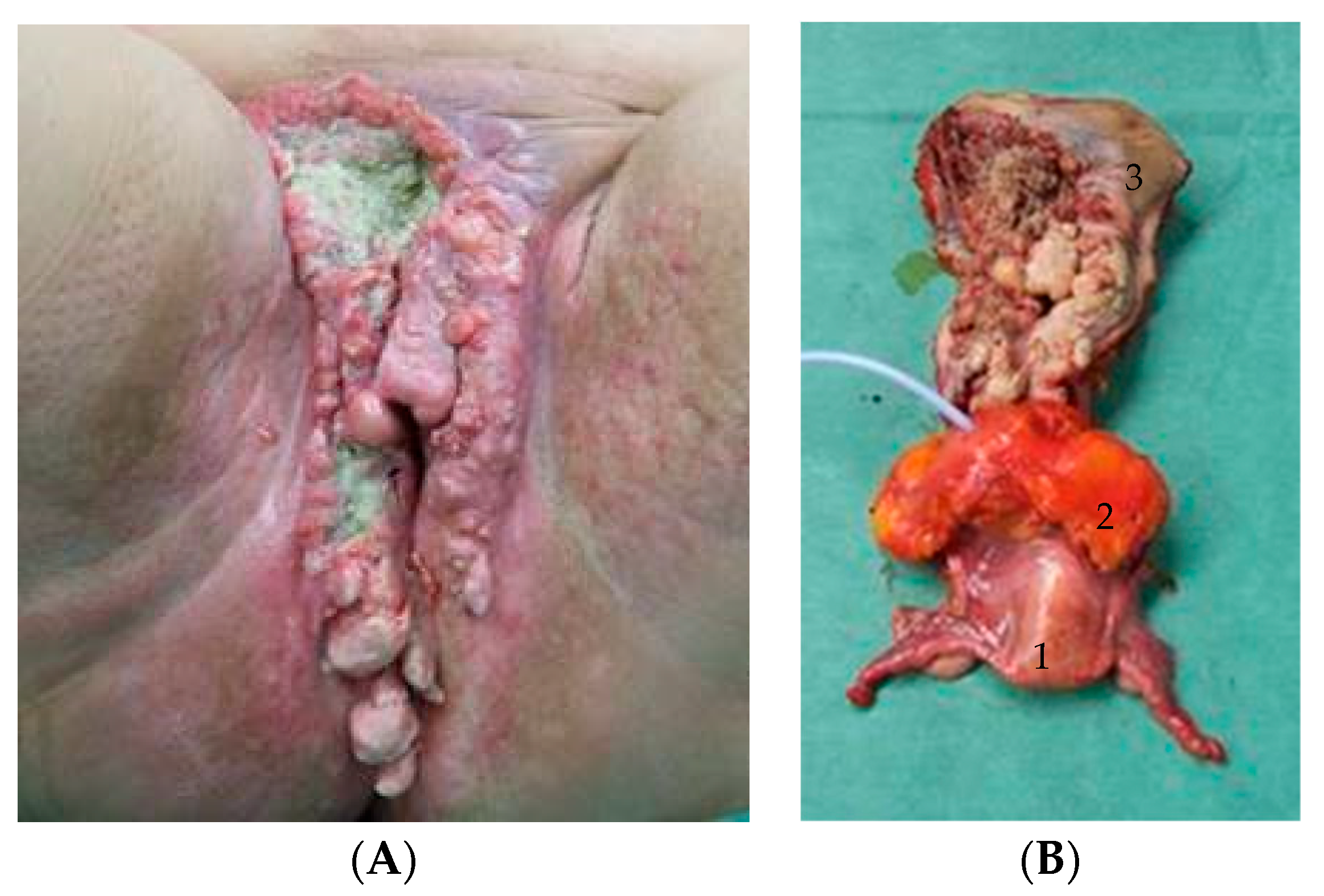Cancers 16 00276 g001