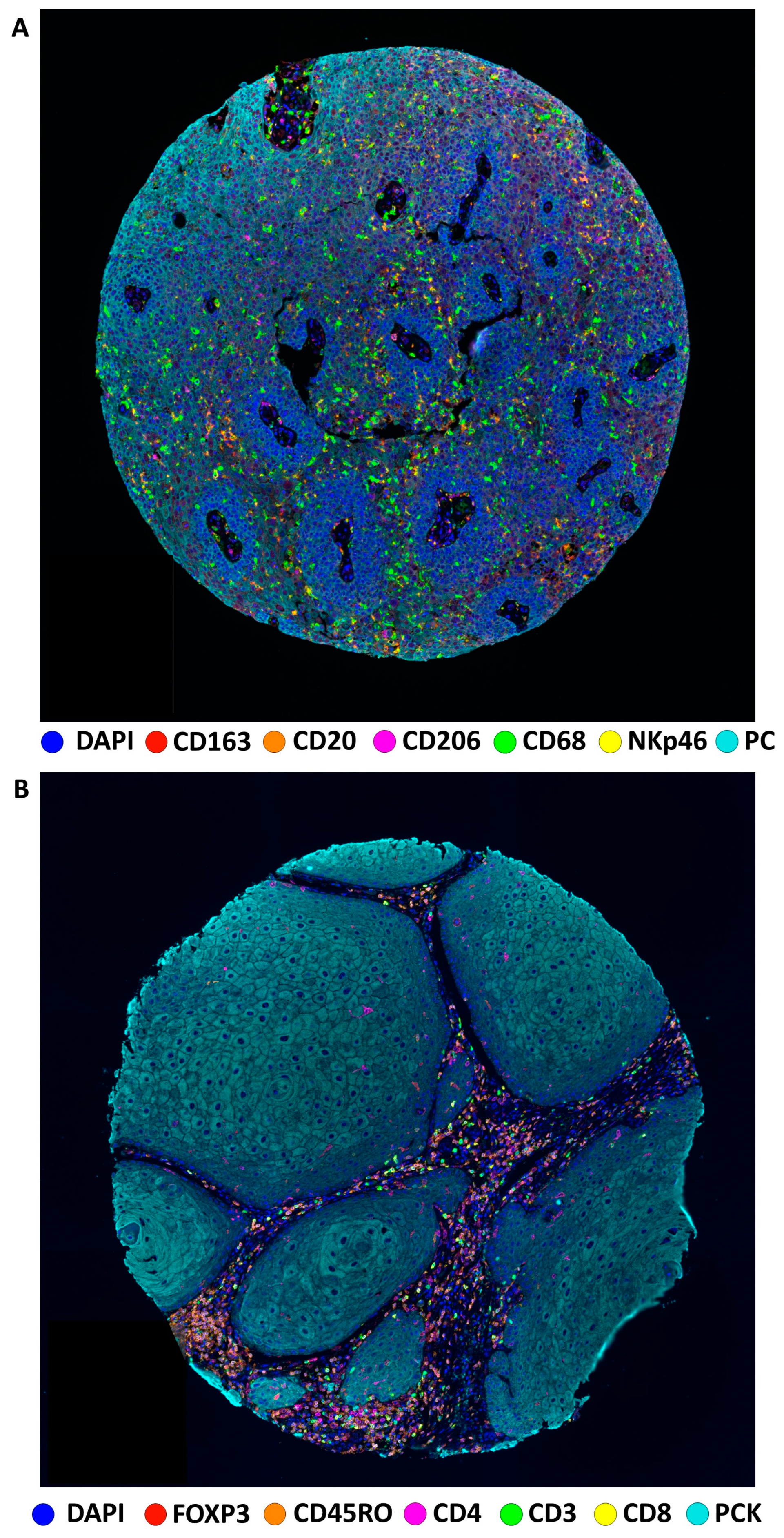 Cancers 16 00303 g001