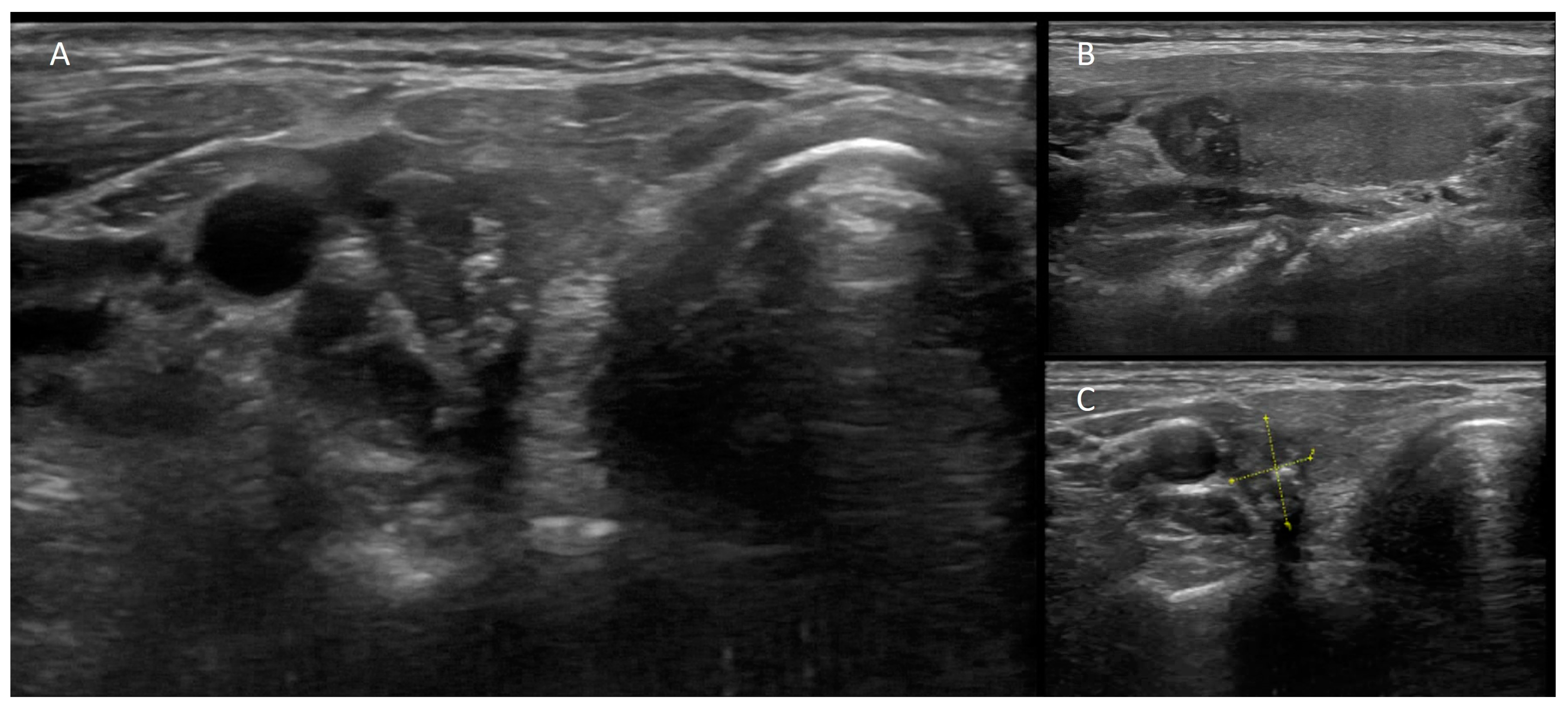 Cancers 16 00311 g002