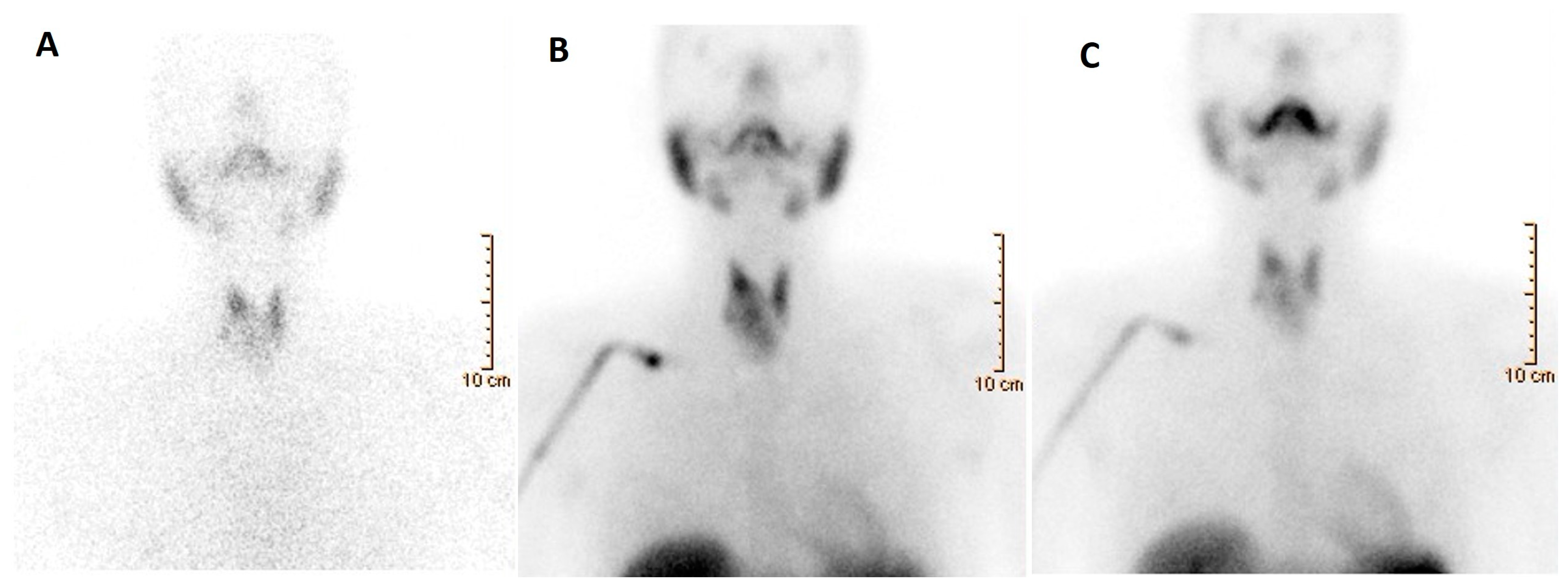 Cancers 16 00311 g004